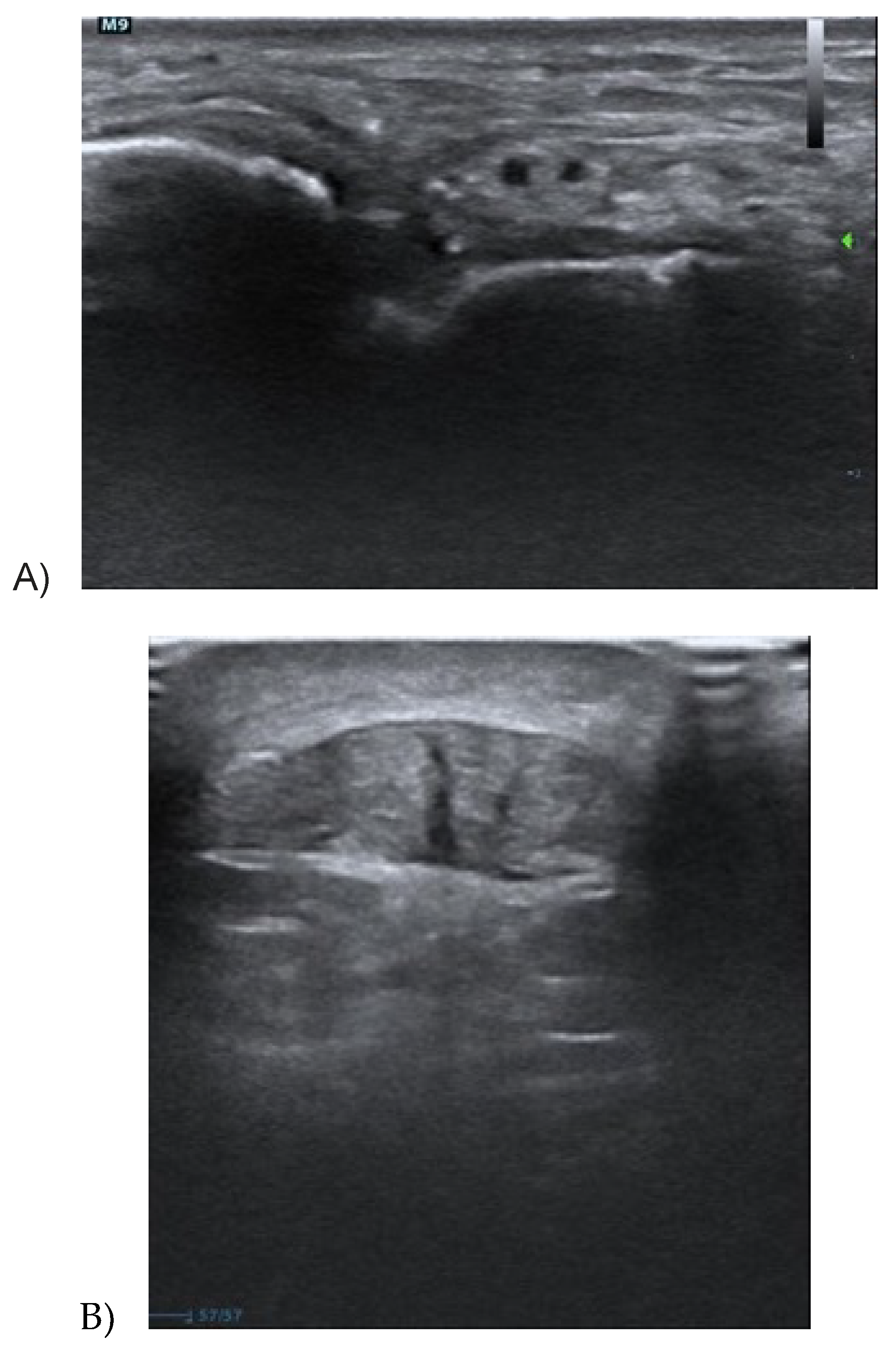 Medicina 56 00378 g003