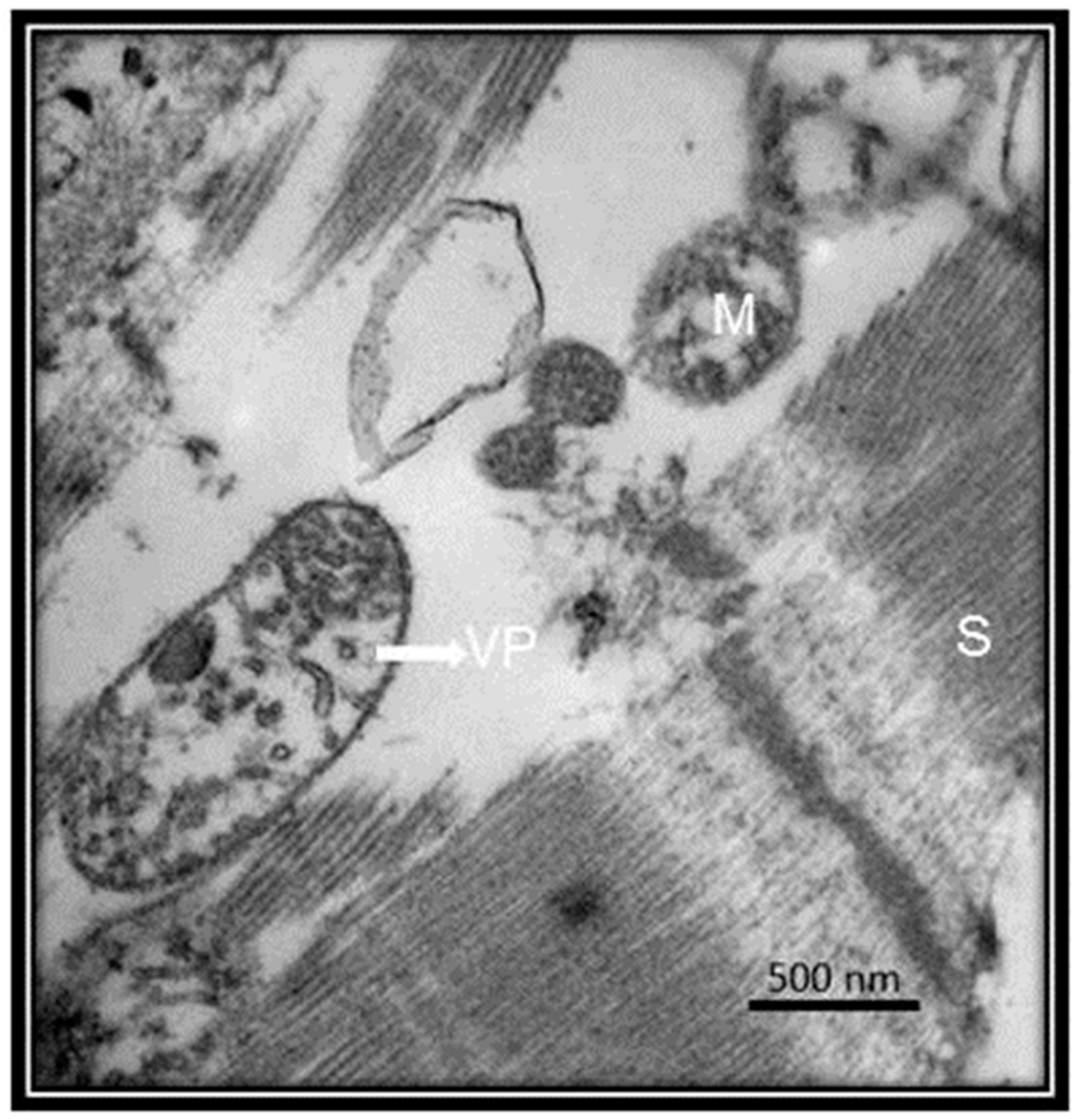 Medicina 56 00386 g004