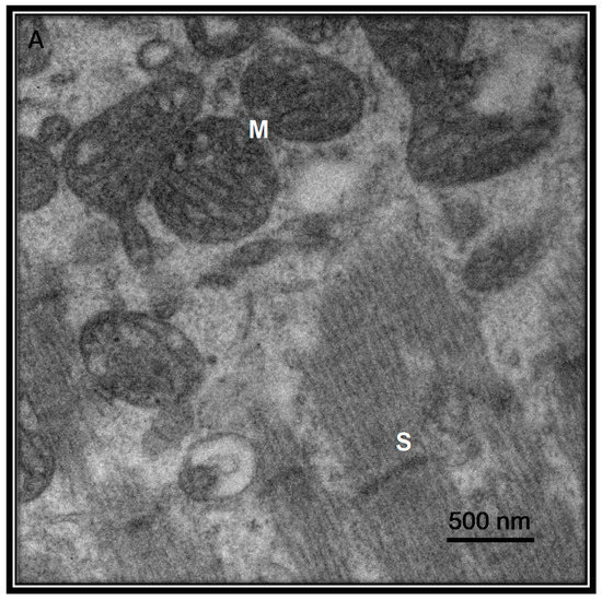 Medicina 56 00386 g005 550