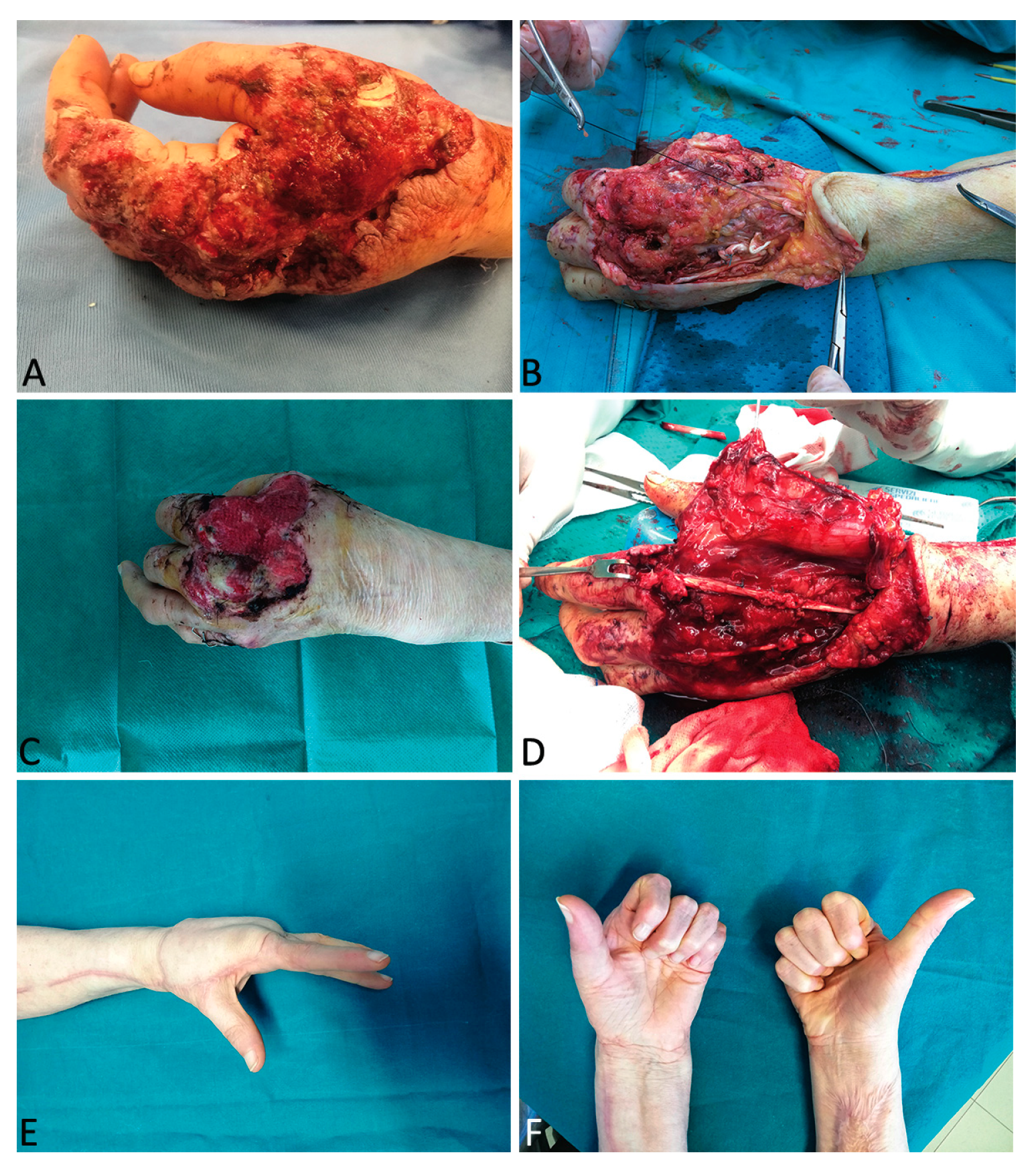 Medicina 56 00398 g003