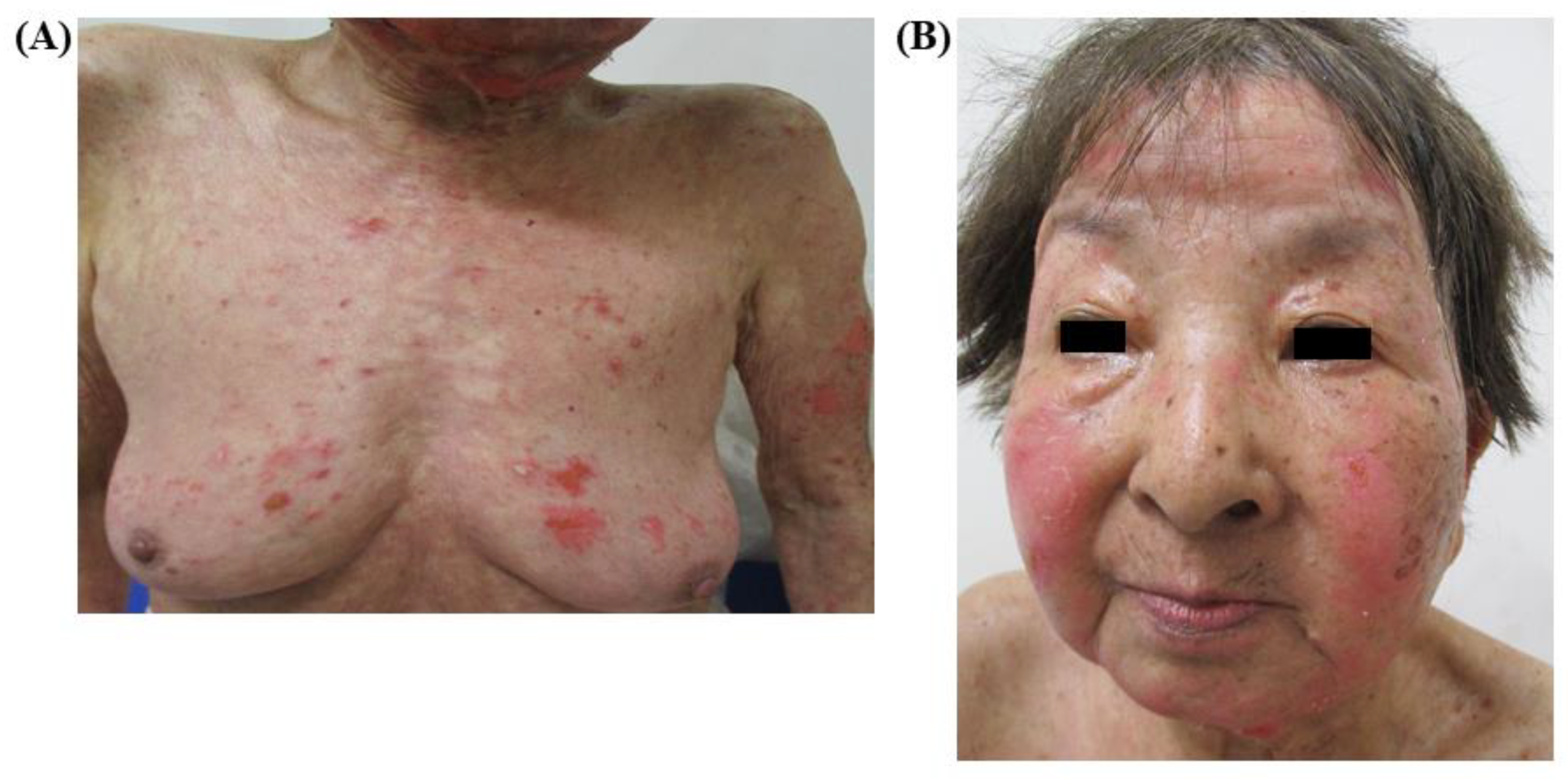 Medicina 56 00403 g002