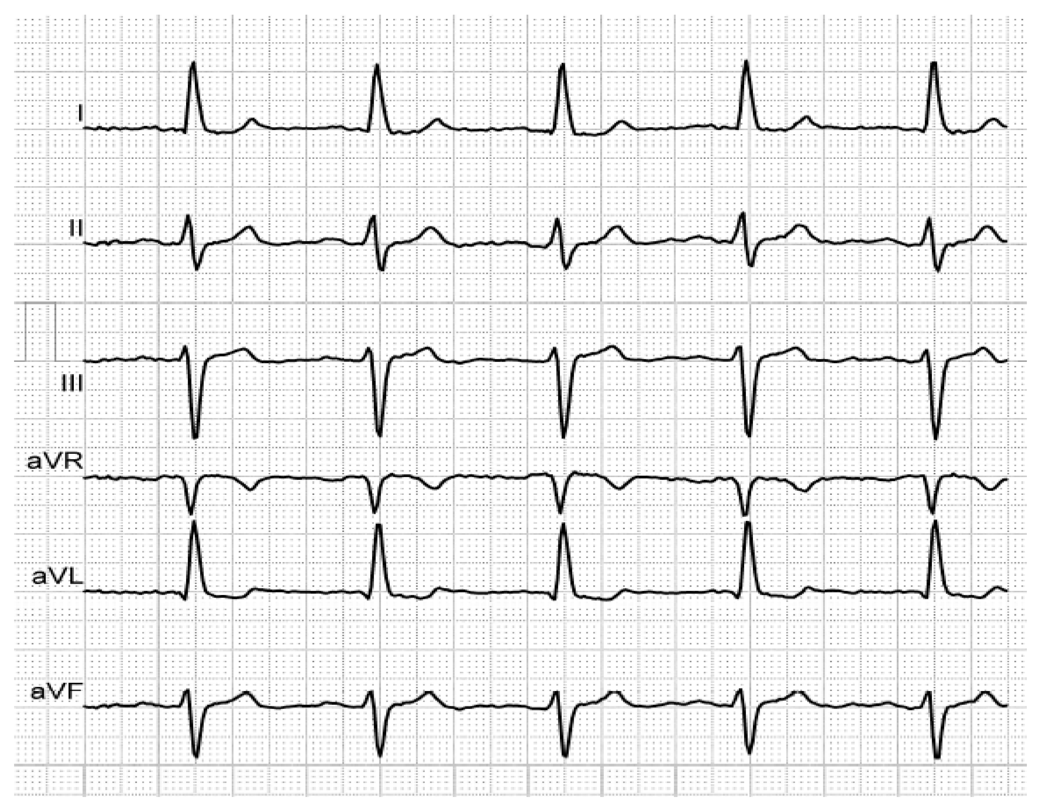 Medicina 56 00410 g003 Medicina 56 00410 g003