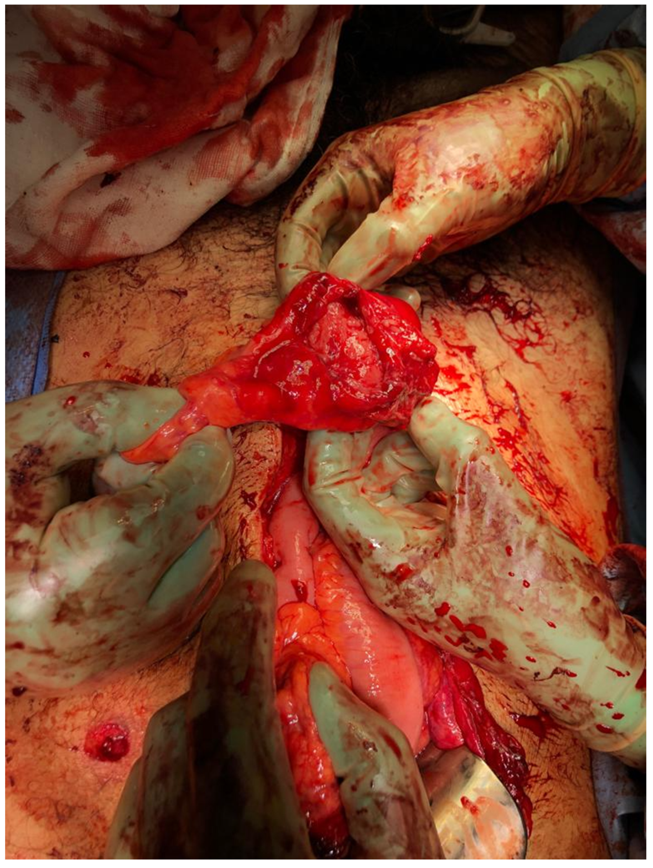 Medicina 56 00440 g003