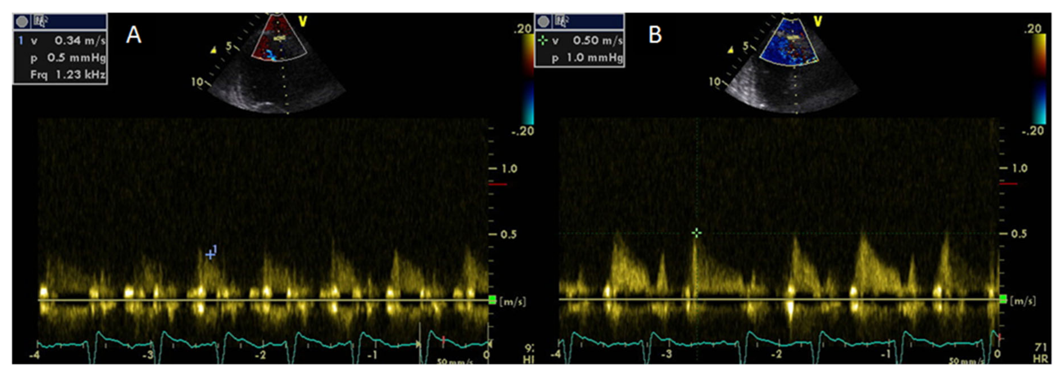 Medicina 56 00445 g002 Medicina 56 00445 g002