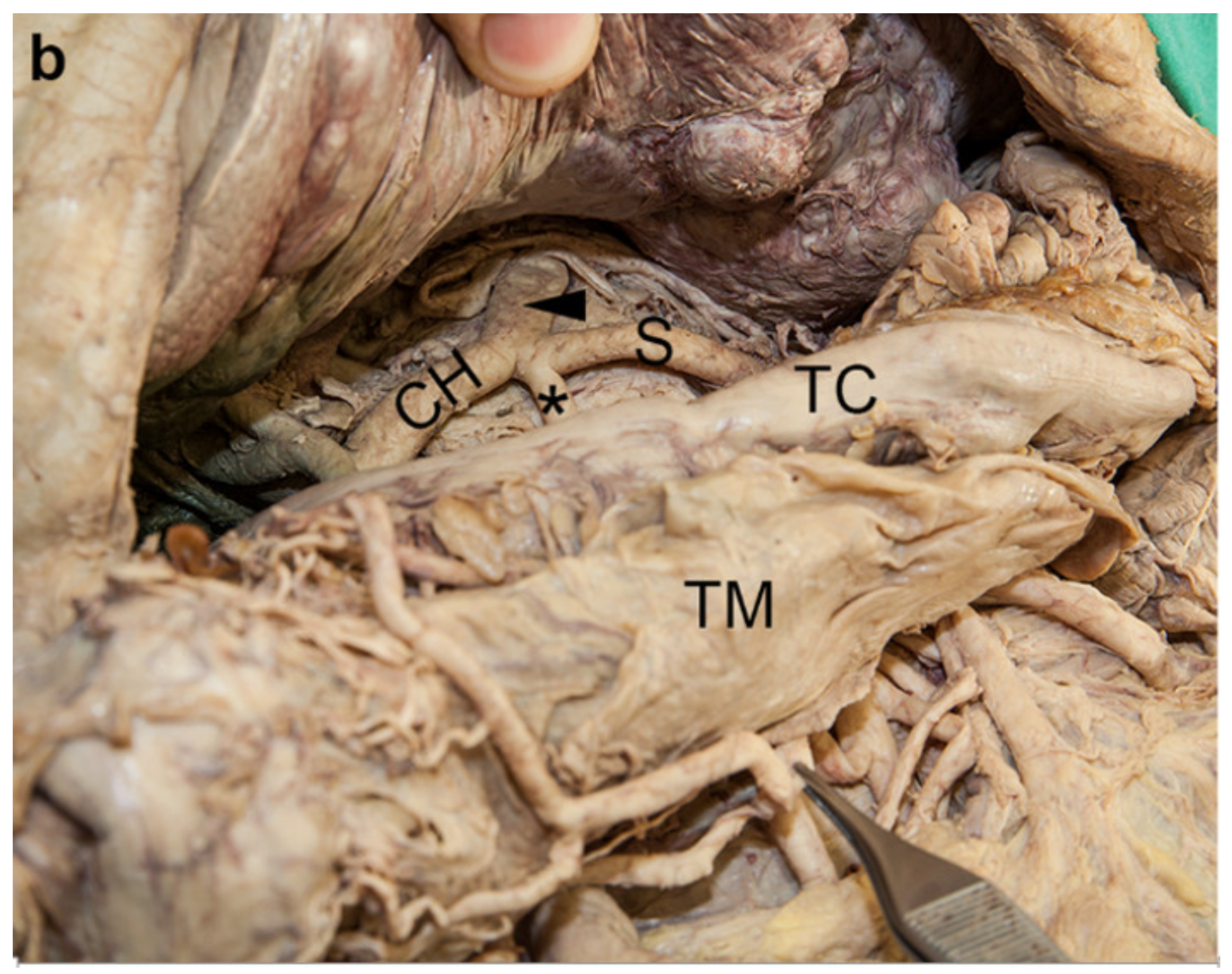 Medicina 56 00449 g001b
