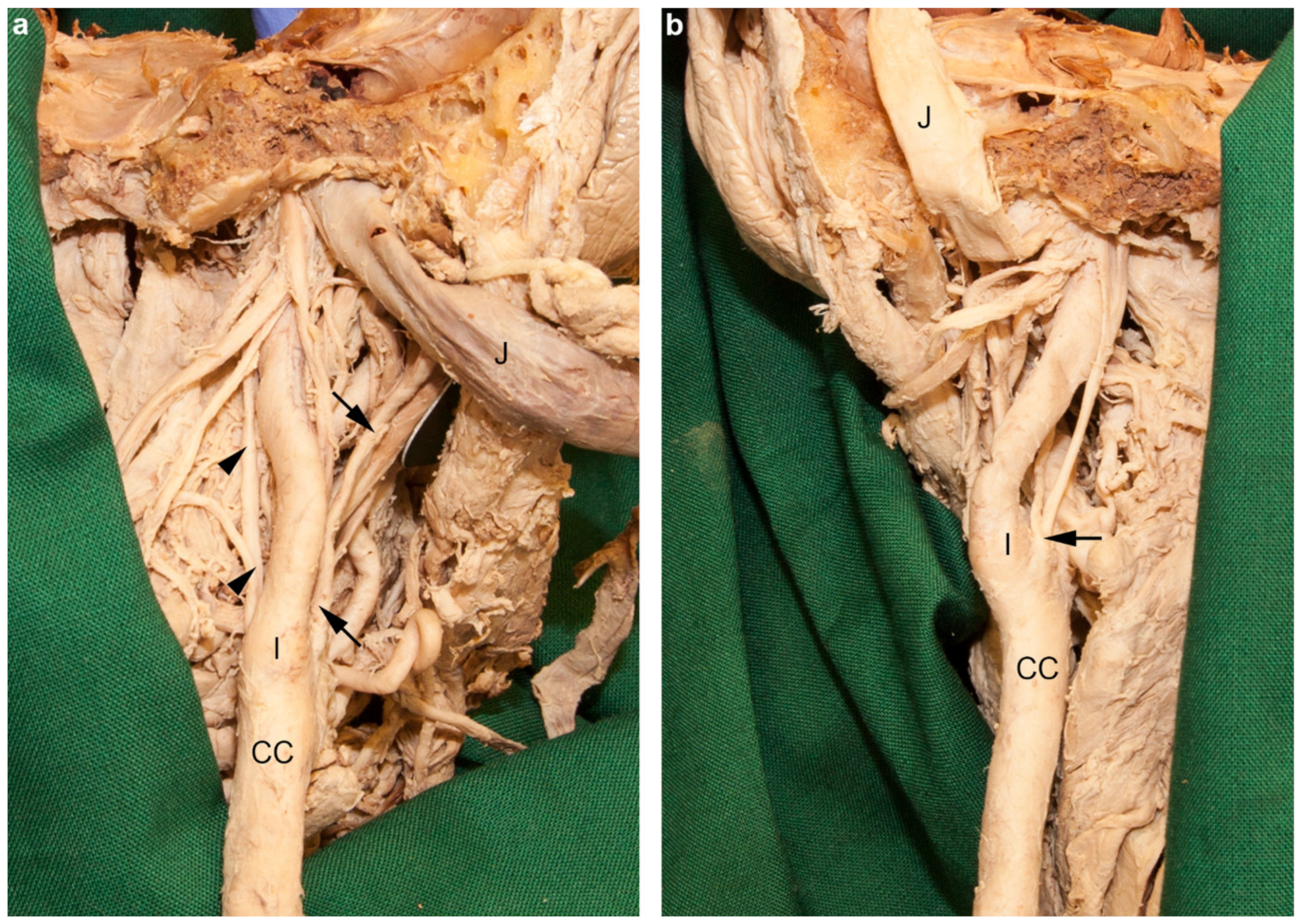 Medicina 56 00449 g006