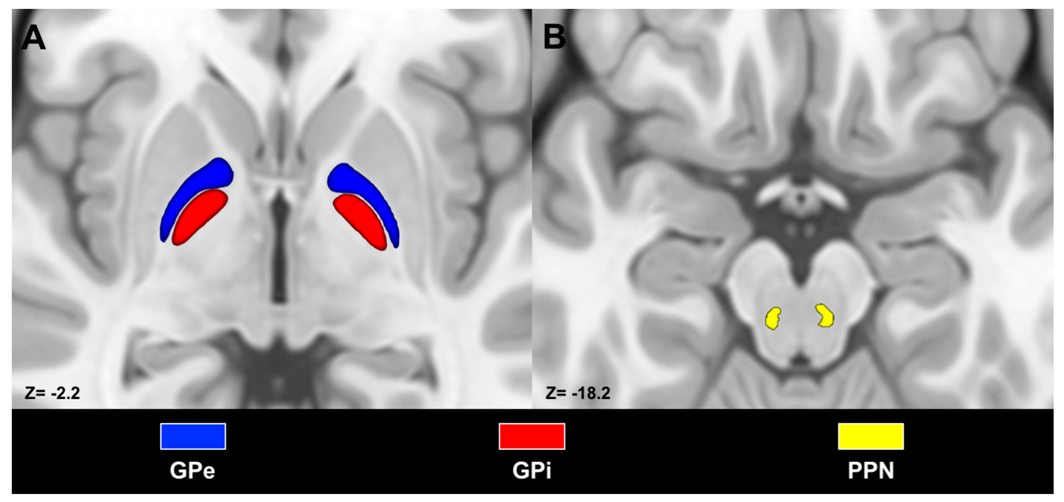 Download Medicina Free Full Text Anatomical Characterization Of The Human Structural Connectivity Between The Pedunculopontine Nucleus And Globus Pallidus Via Multi Shell Multi Tissue Tractography Html PSD Mockup Templates