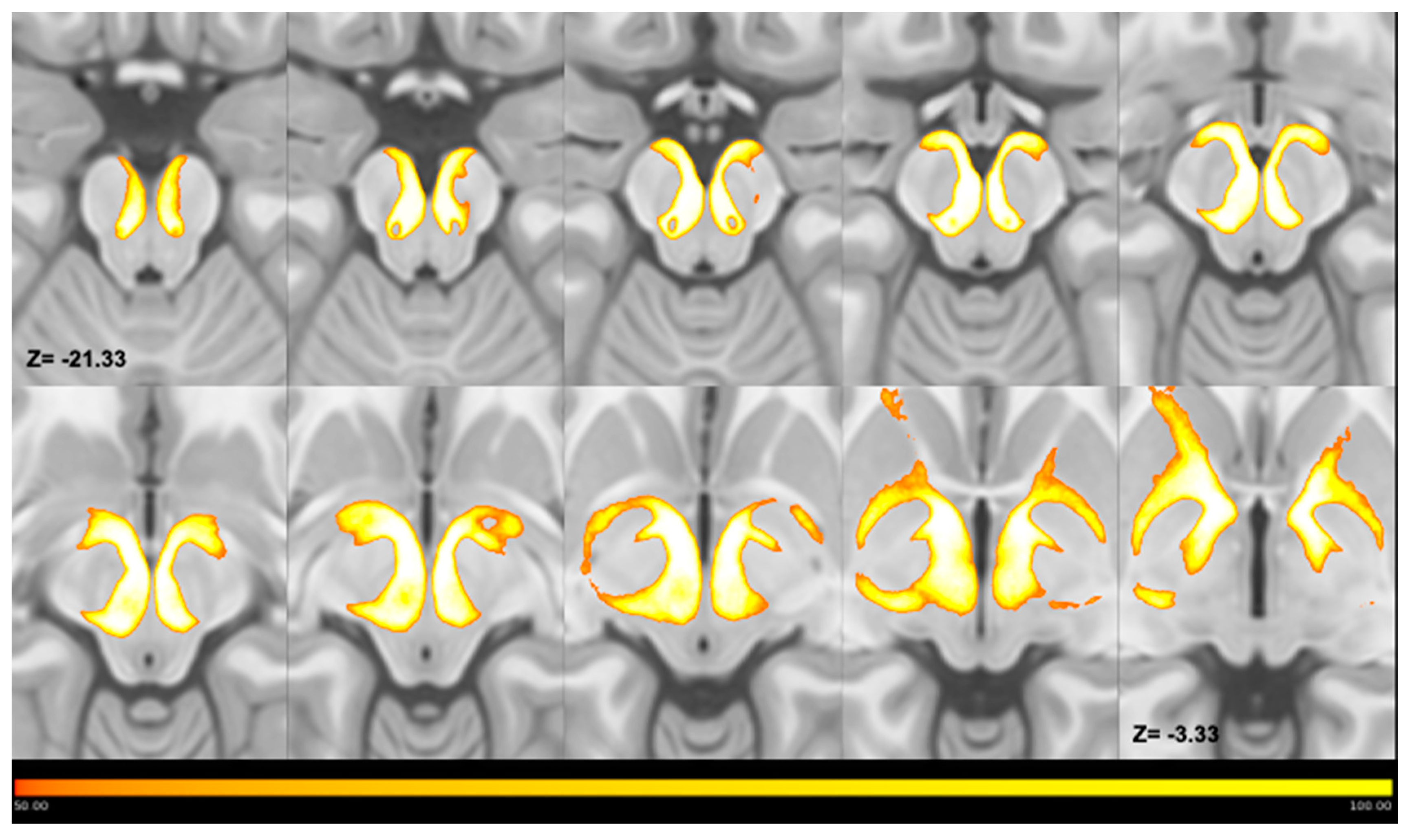 Download Medicina Free Full Text Anatomical Characterization Of The Human Structural Connectivity Between The Pedunculopontine Nucleus And Globus Pallidus Via Multi Shell Multi Tissue Tractography Html PSD Mockup Templates