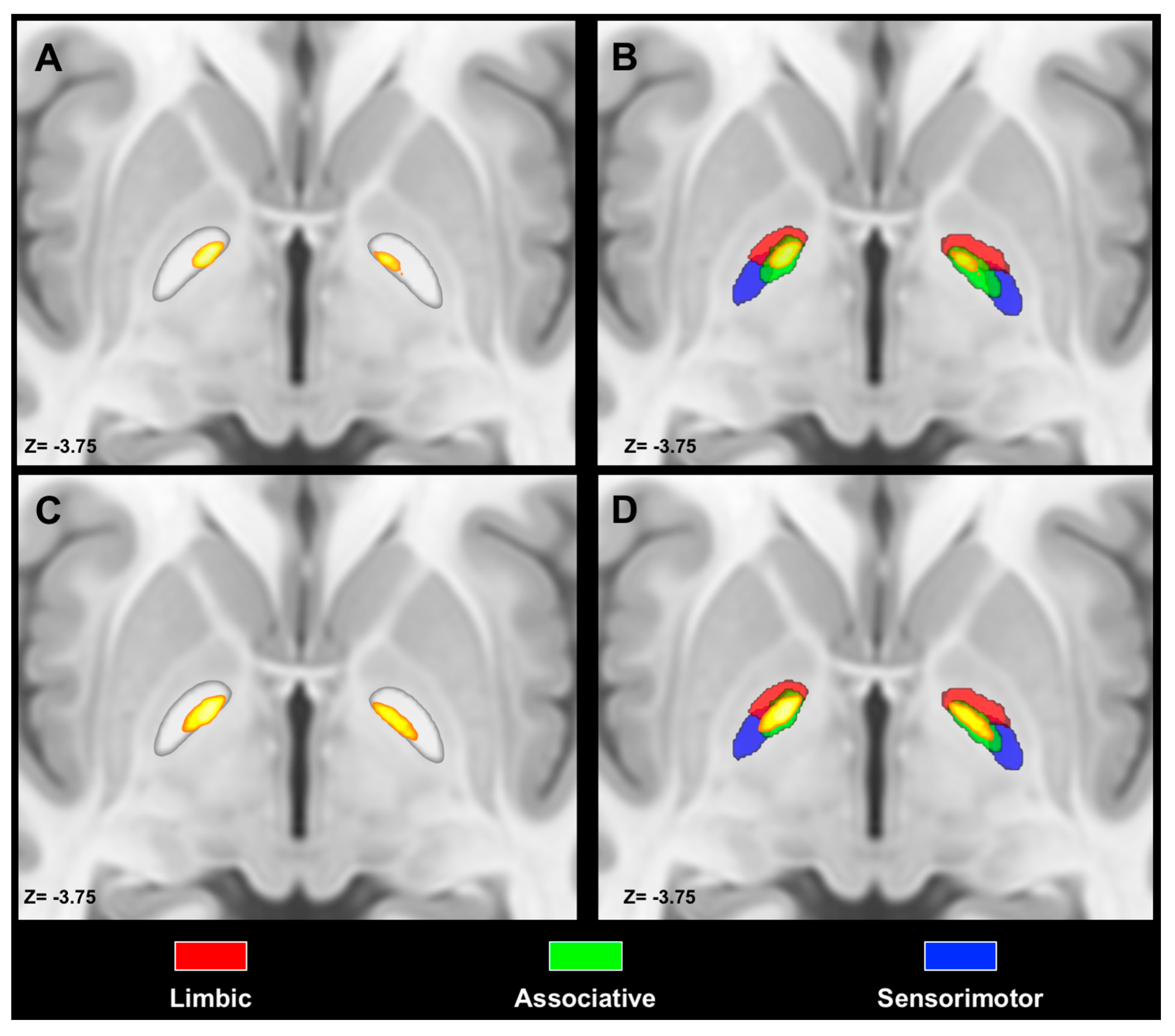 Download Medicina Free Full Text Anatomical Characterization Of The Human Structural Connectivity Between The Pedunculopontine Nucleus And Globus Pallidus Via Multi Shell Multi Tissue Tractography Html PSD Mockup Templates
