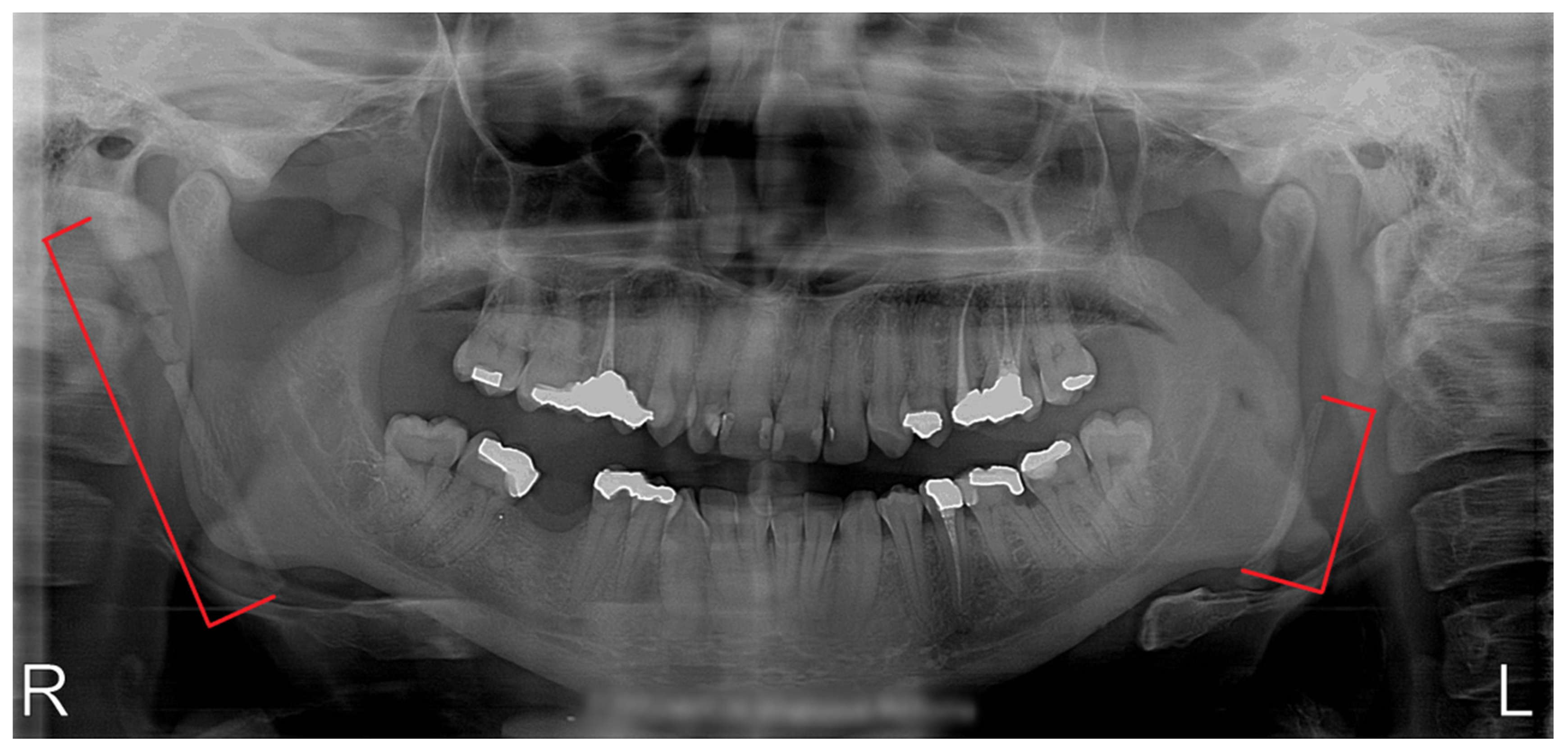 Styloid process