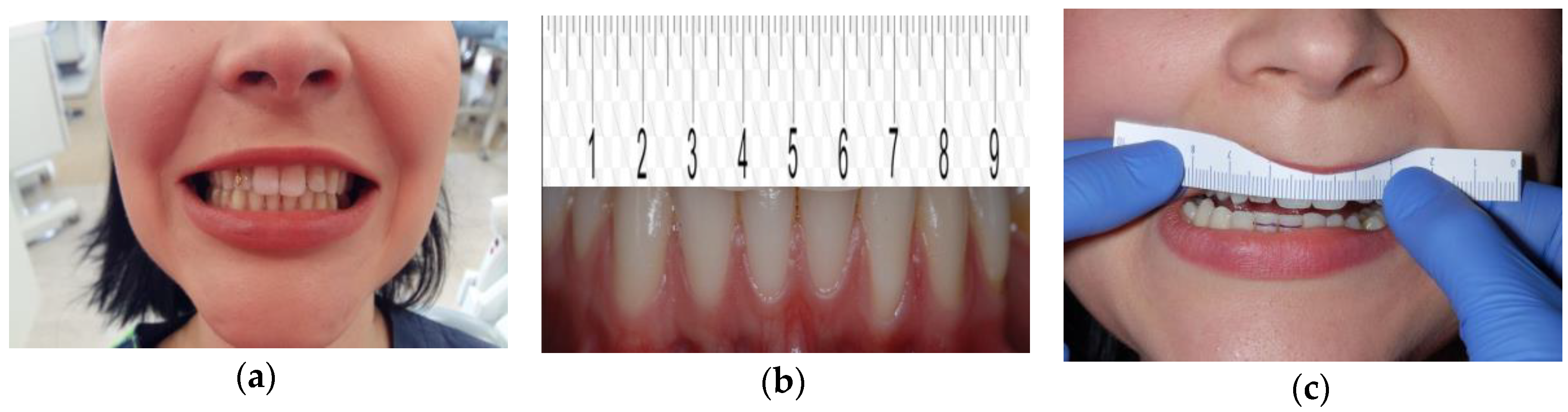 Medicina 56 00472 g004 Medicina 56 00472 g004