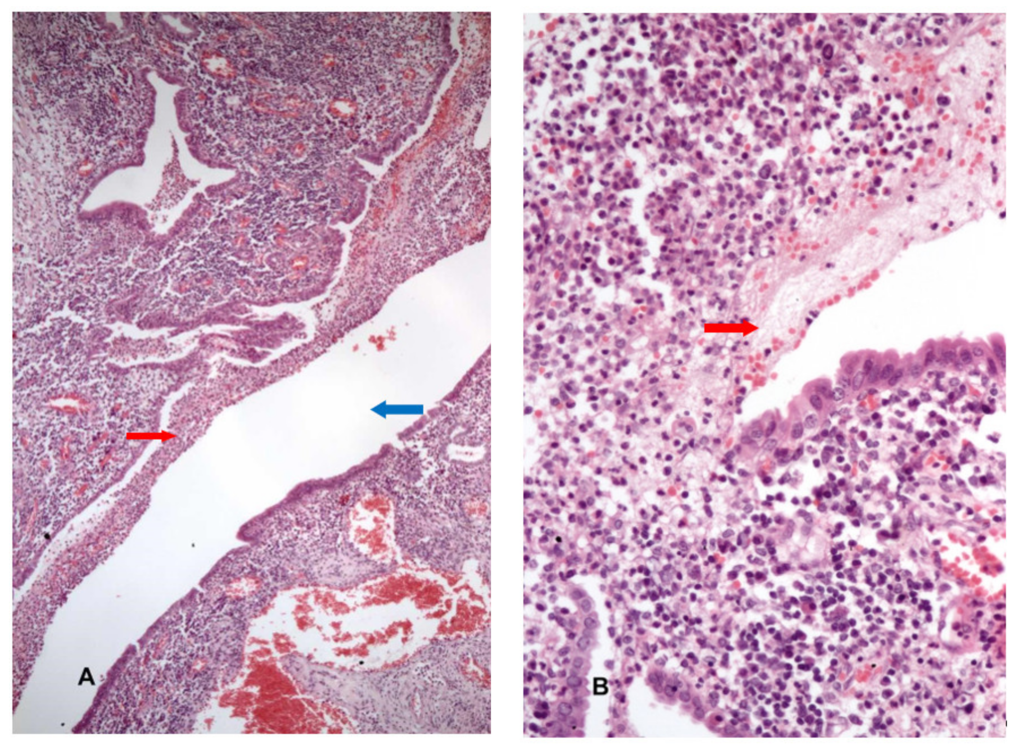 Medicina 56 00477 g003