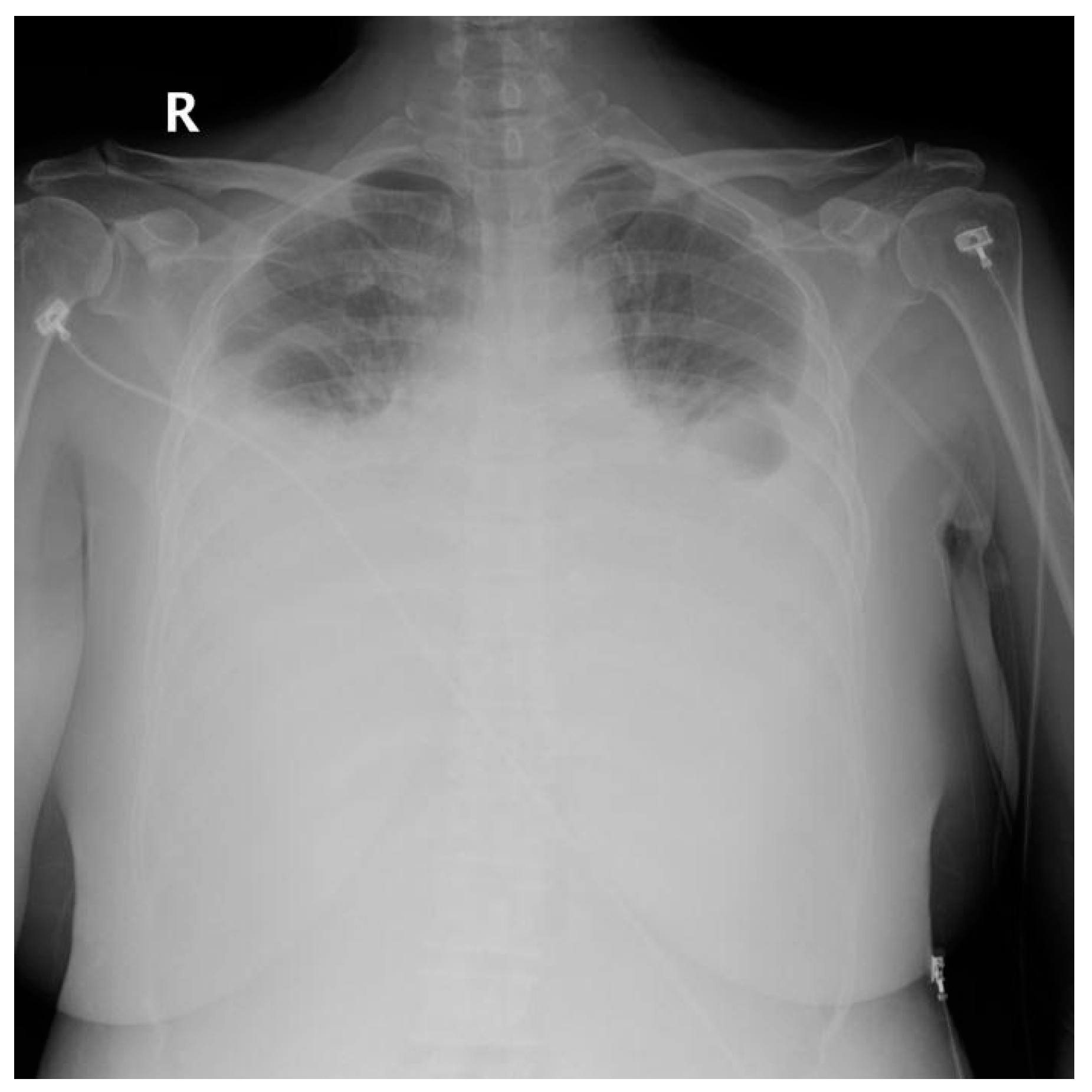 Medicina 56 00481 g004