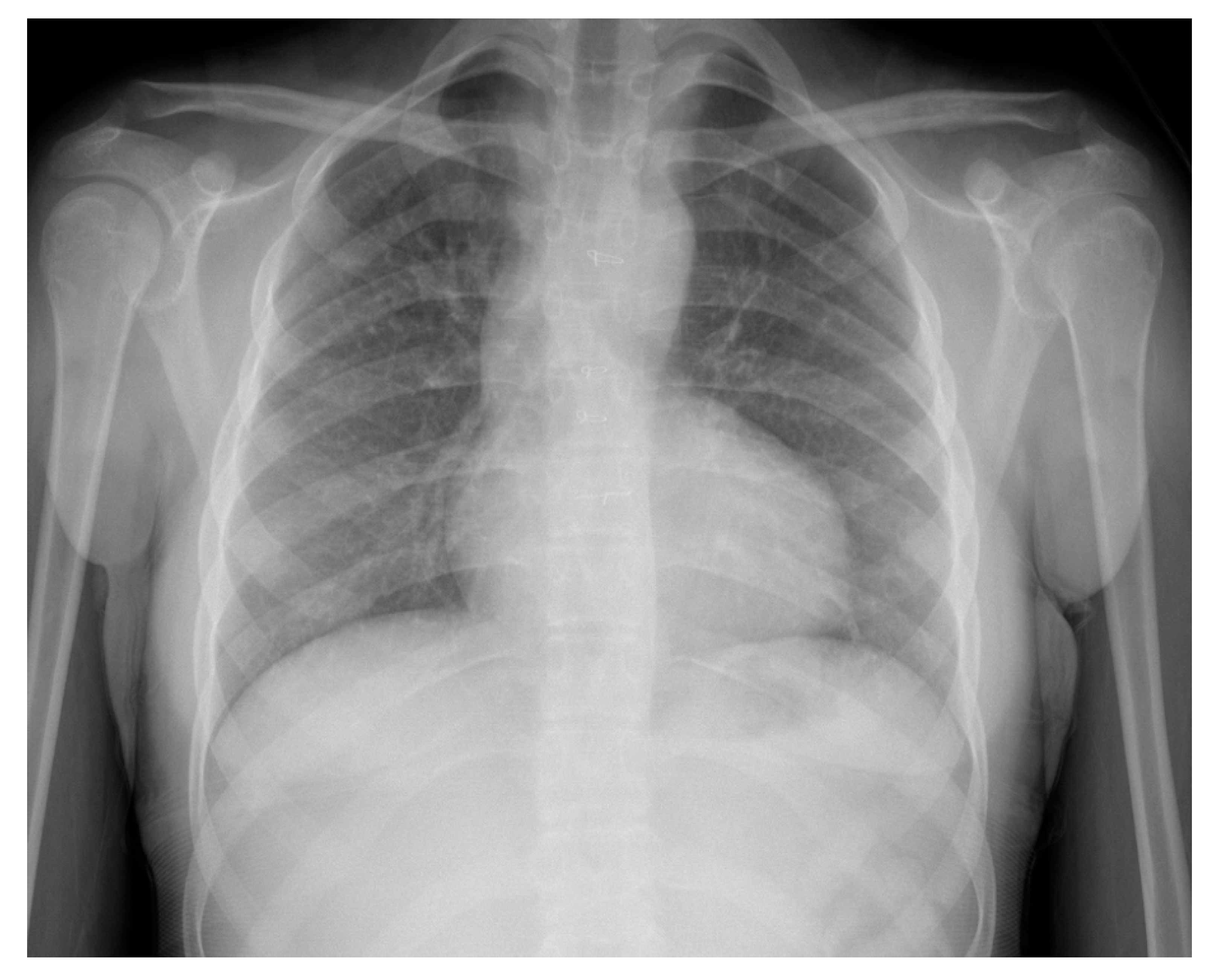 Medicina 56 00492 g002