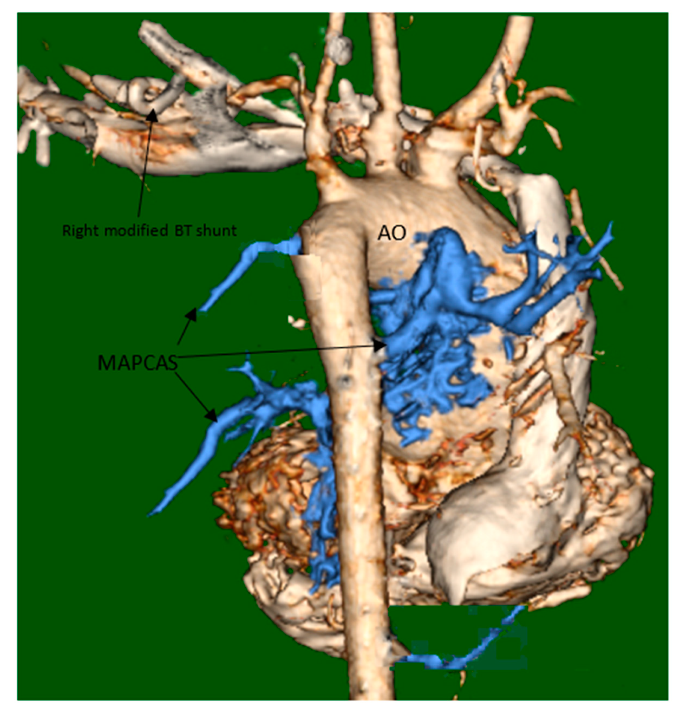 Medicina 56 00492 g003