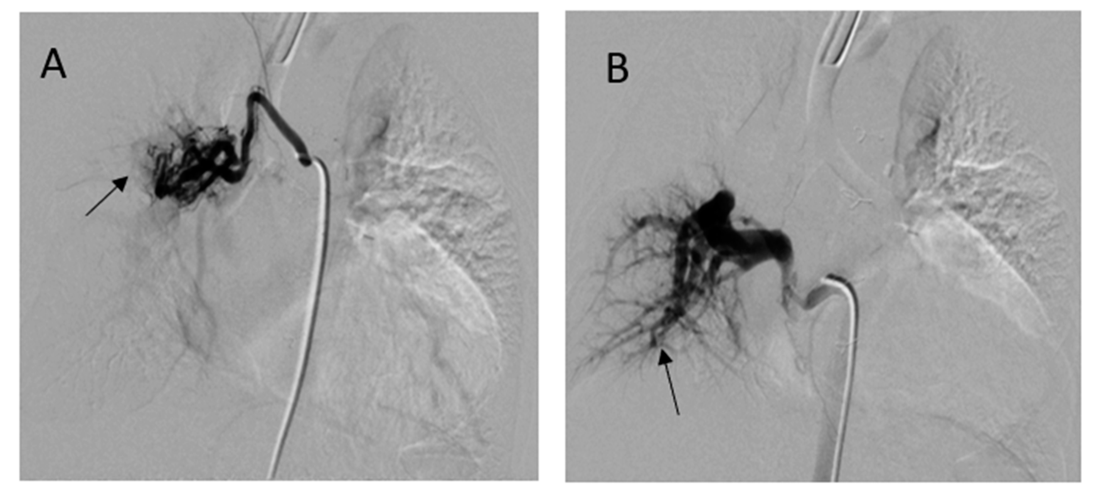 Medicina 56 00492 g004