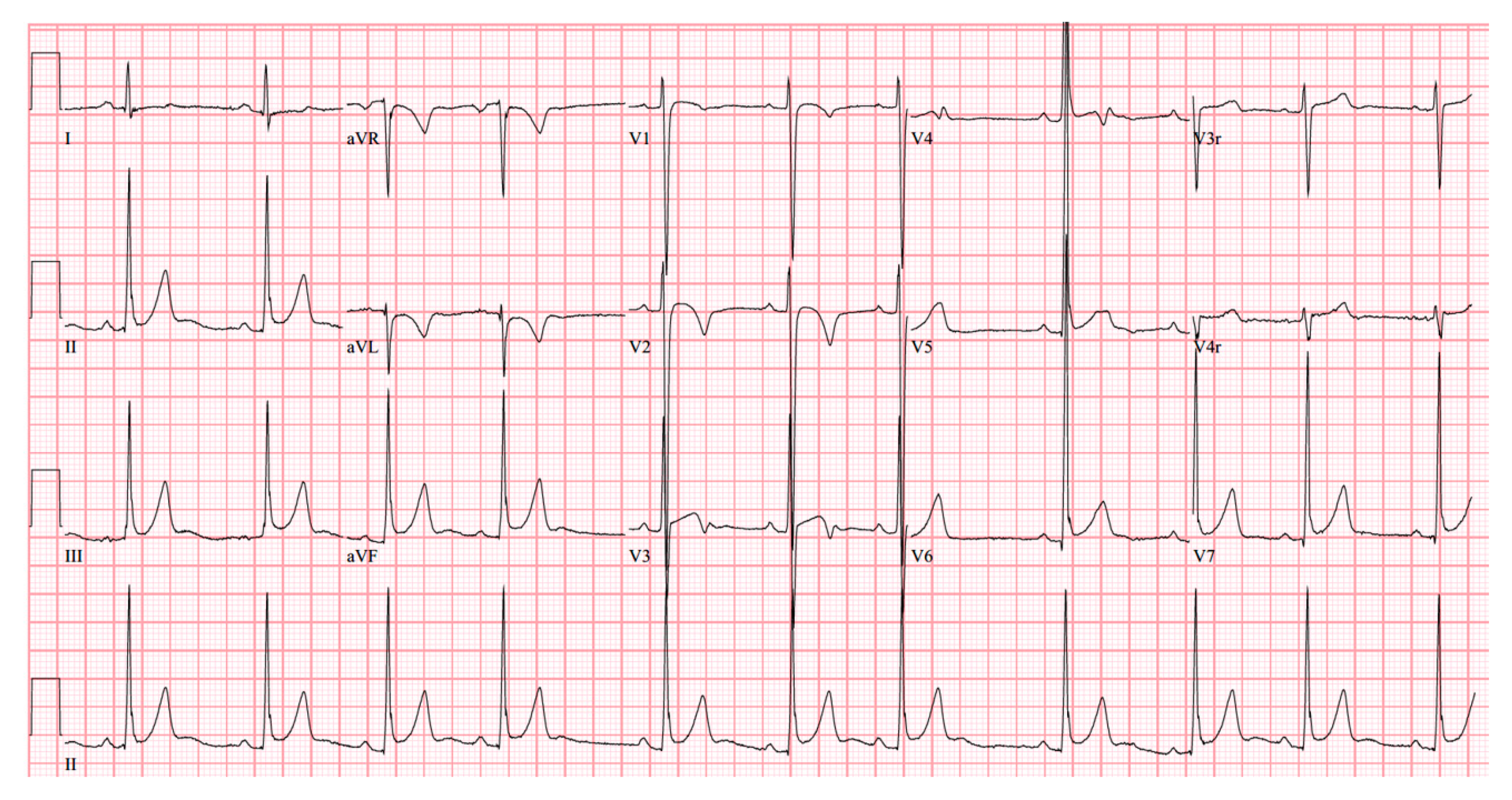 Medicina 56 00492 g005