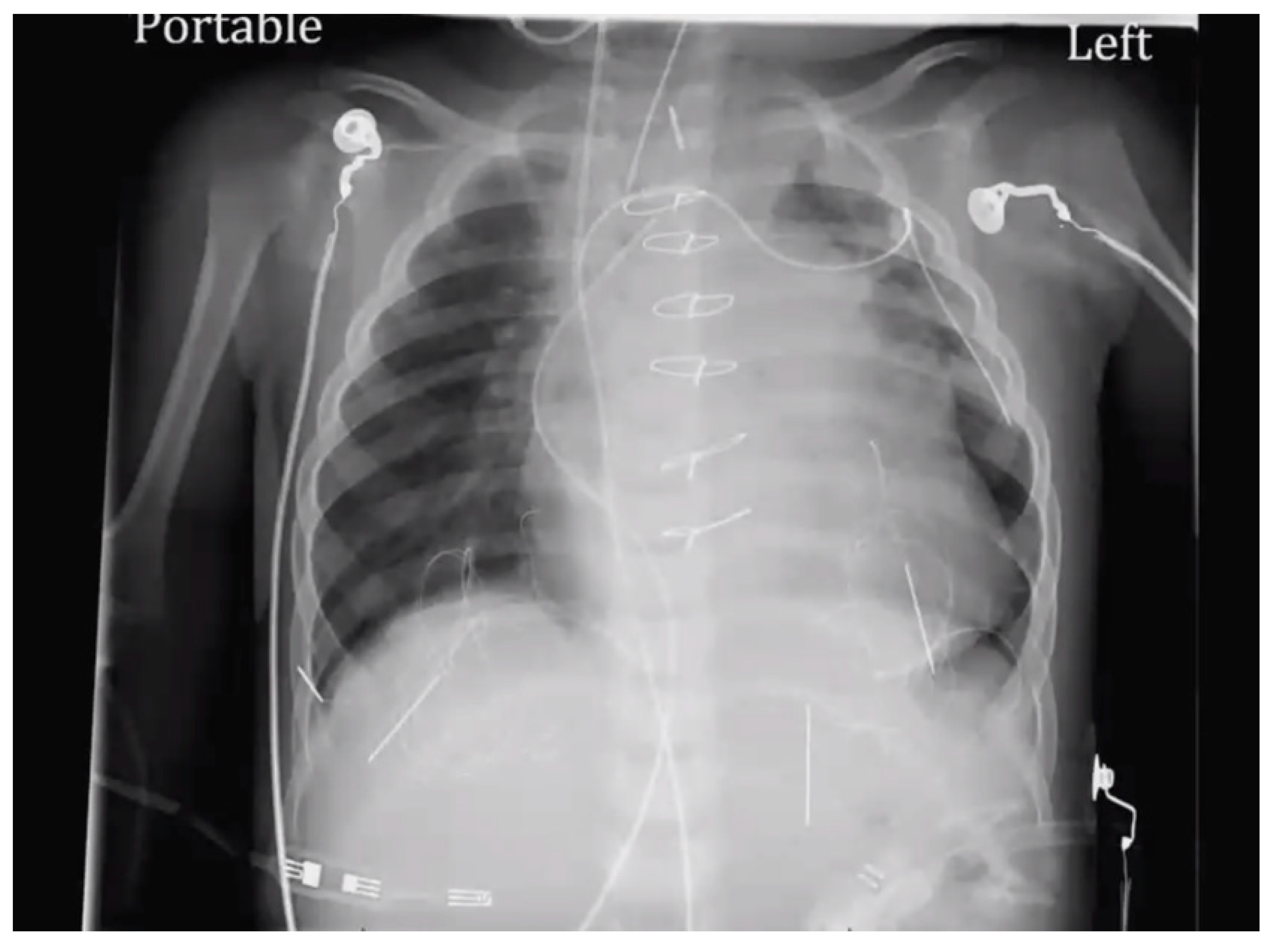 Medicina 56 00492 g006