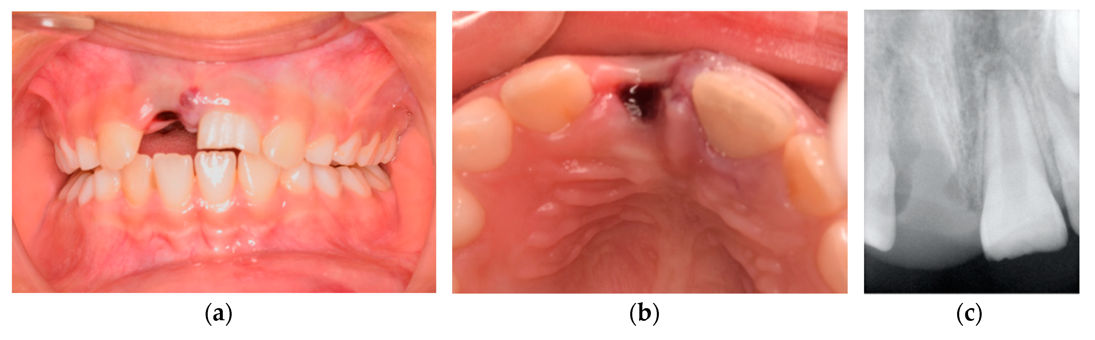 Medicina 56 00503 g001