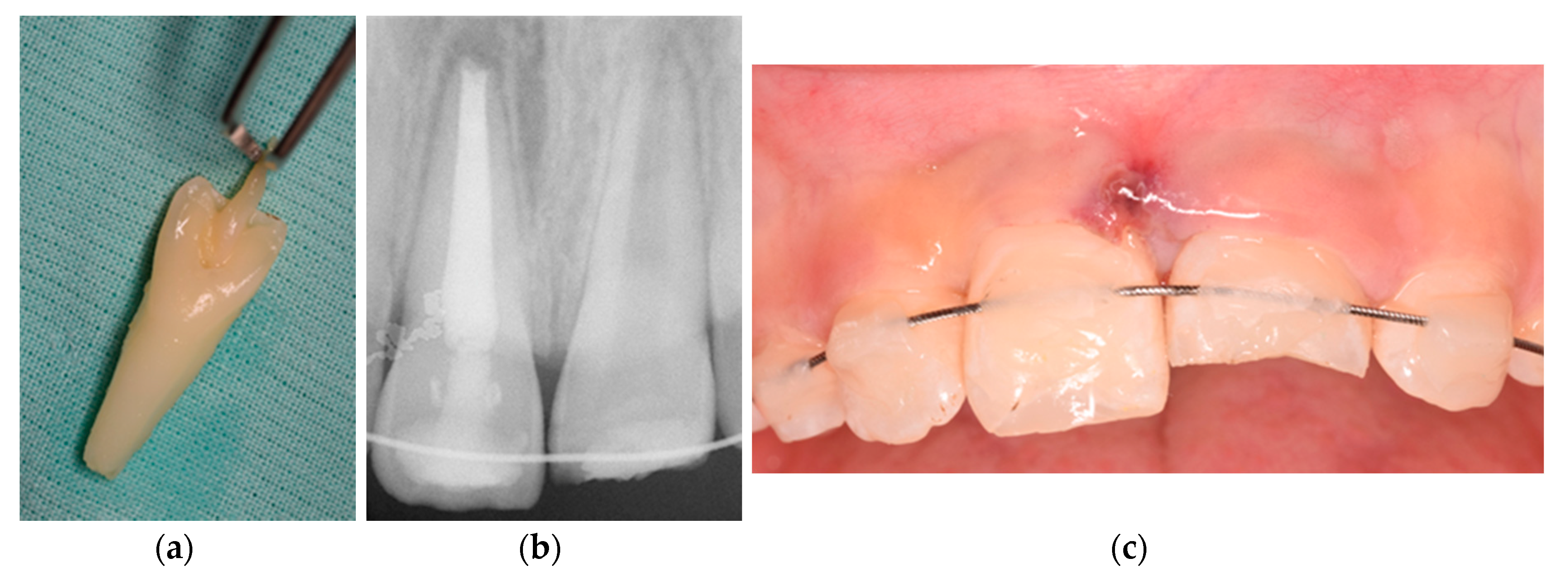 Medicina 56 00503 g002