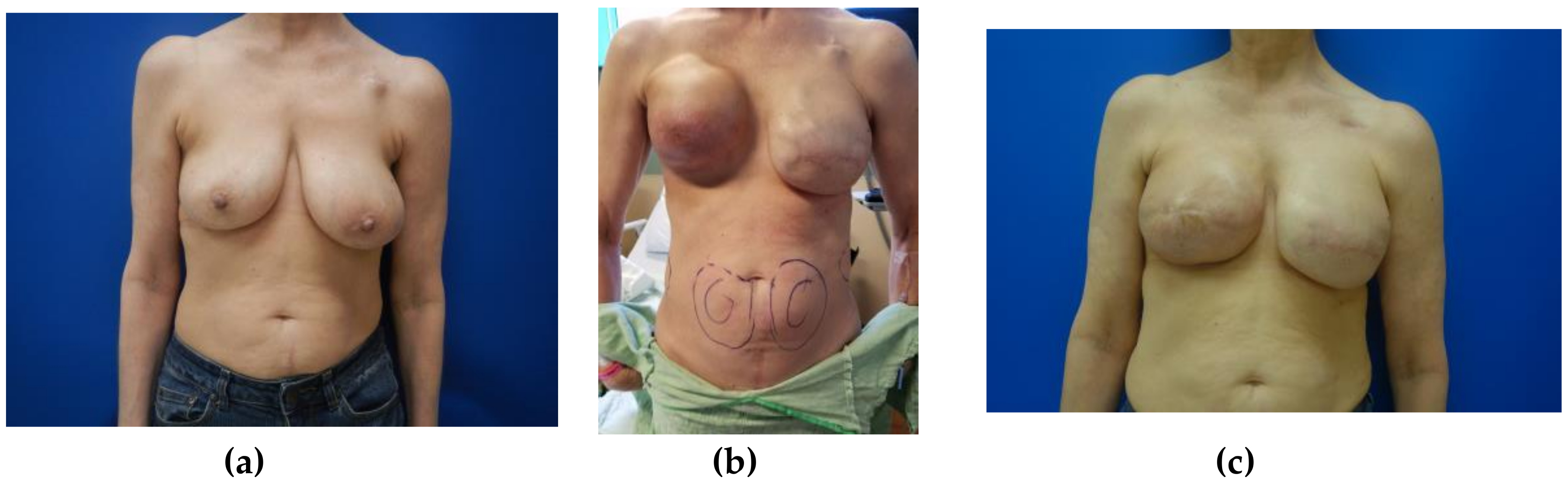 Medicina 56 00516 g002