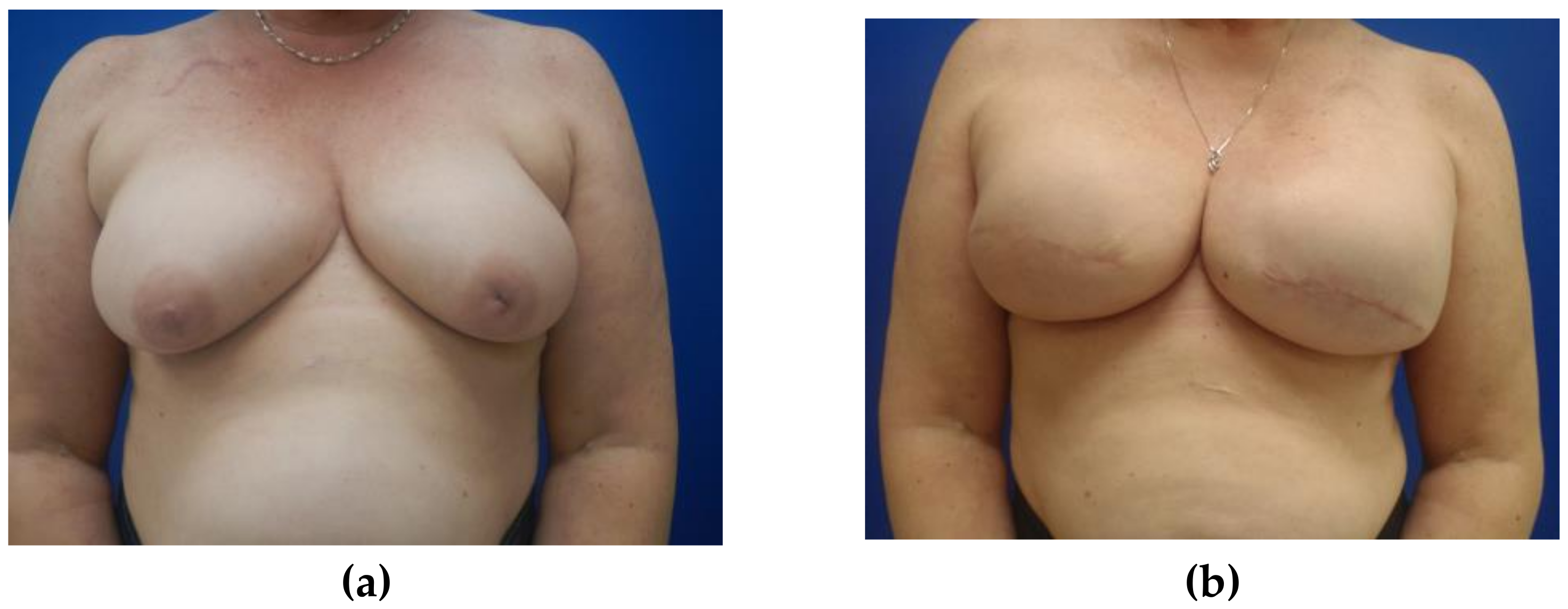 Medicina 56 00516 g003