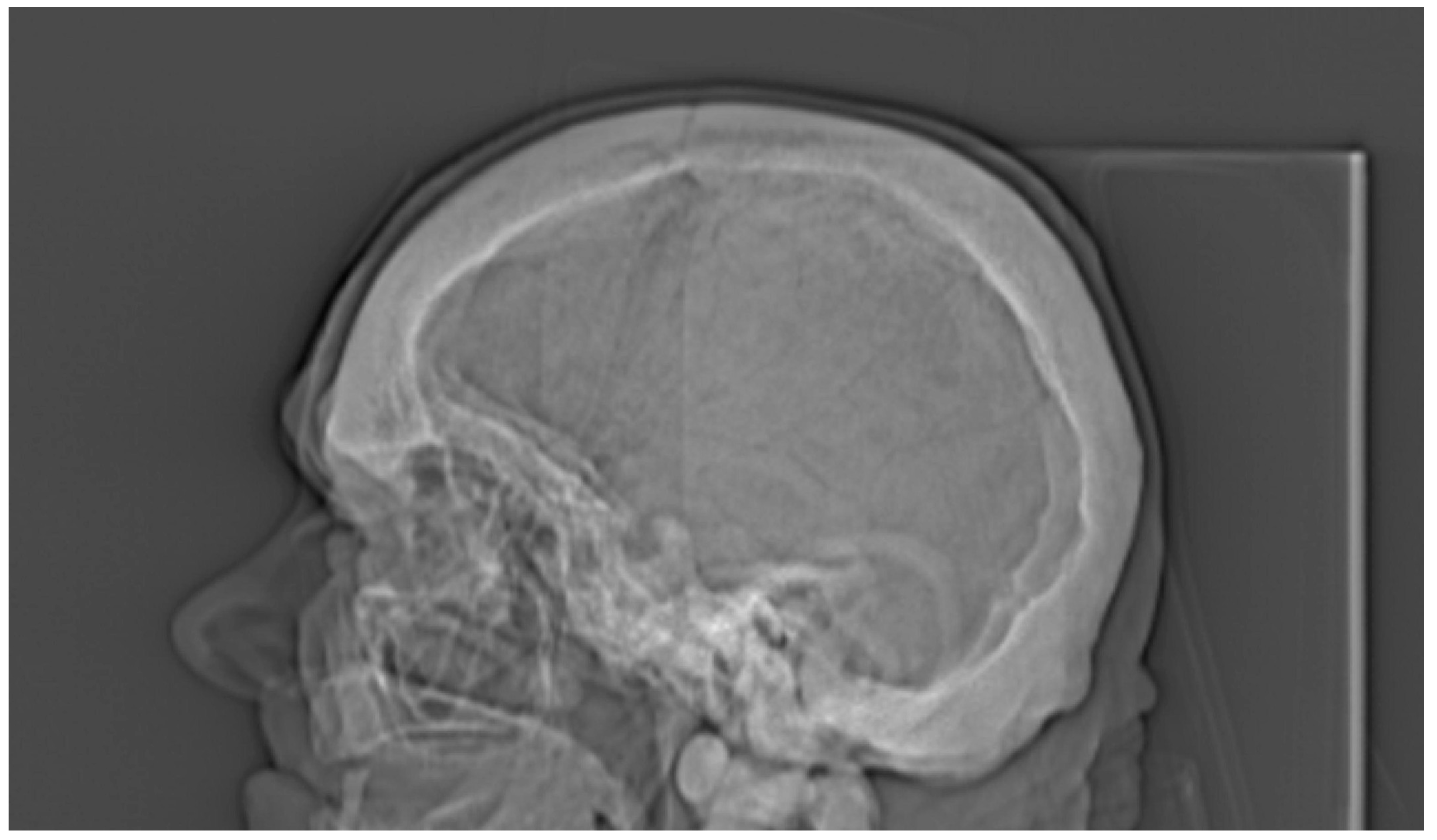 Medicina 56 00518 g004