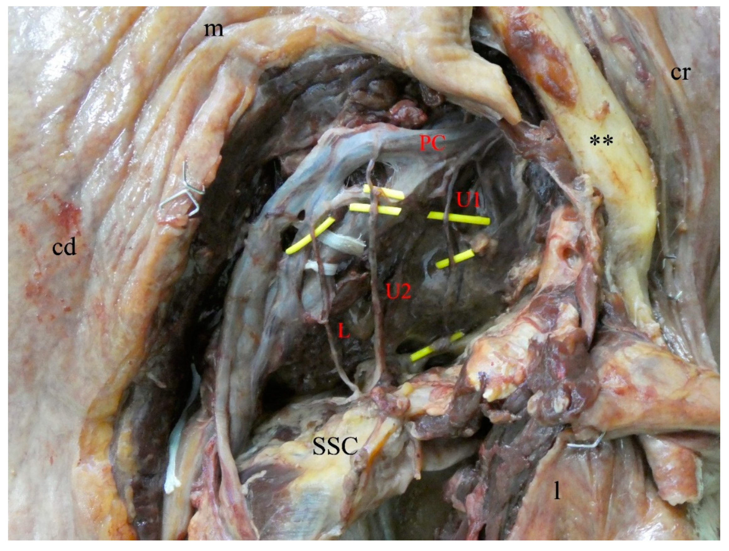 Medicina 56 00532 g001