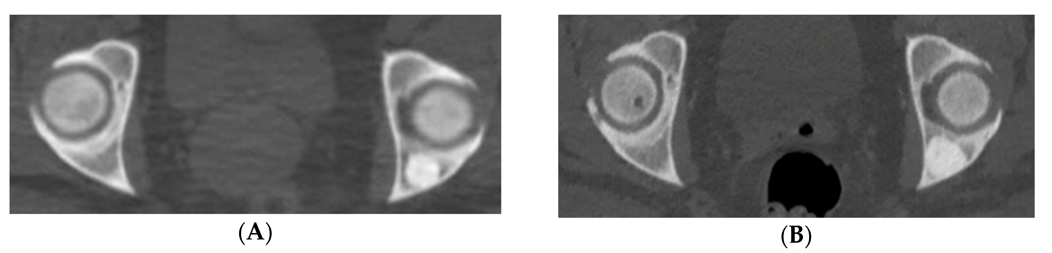 Medicina 56 00534 g003a