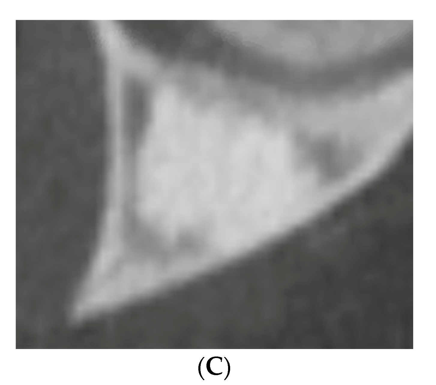 Medicina 56 00534 g003b