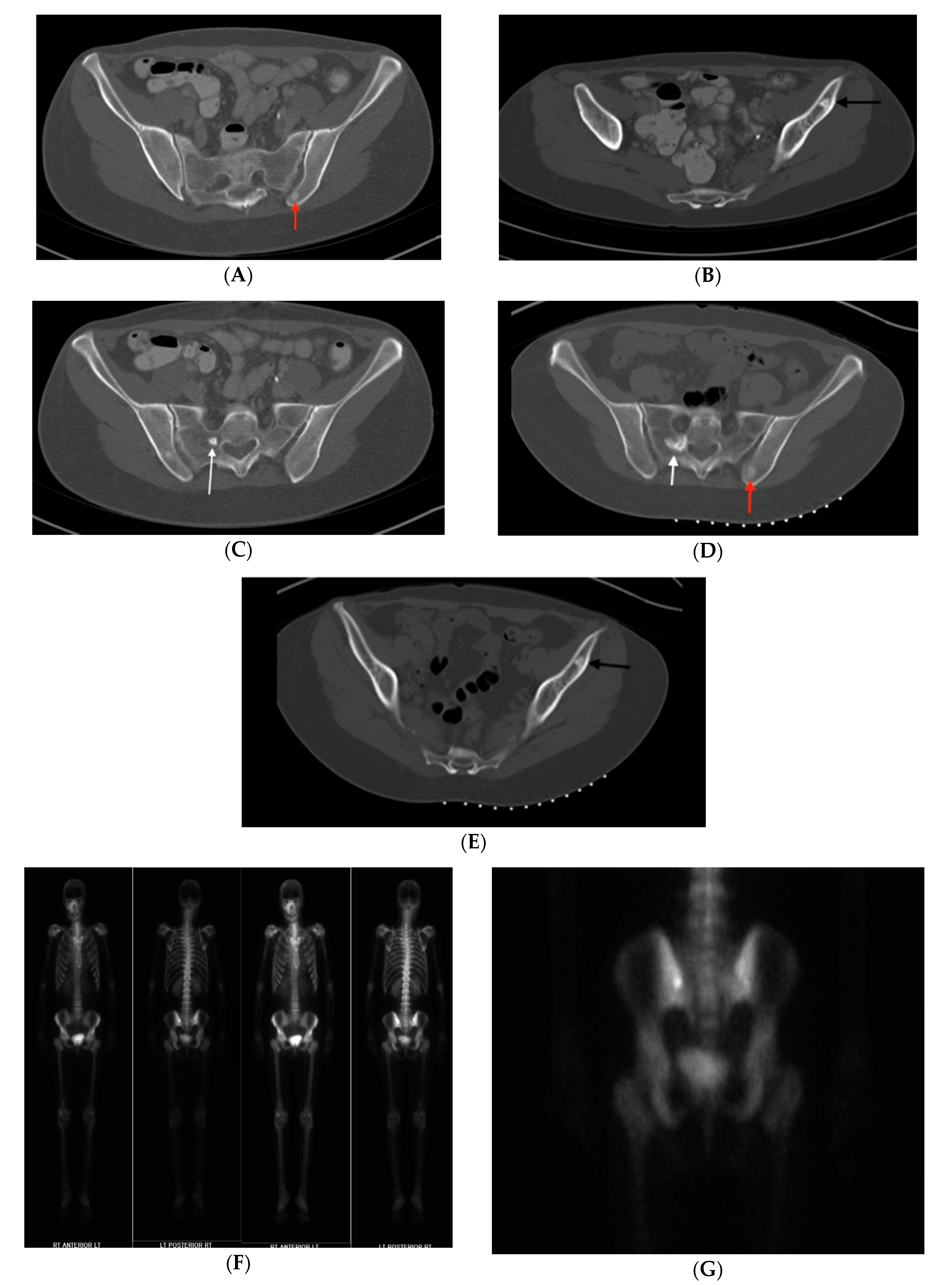 Medicina 56 00534 g004a