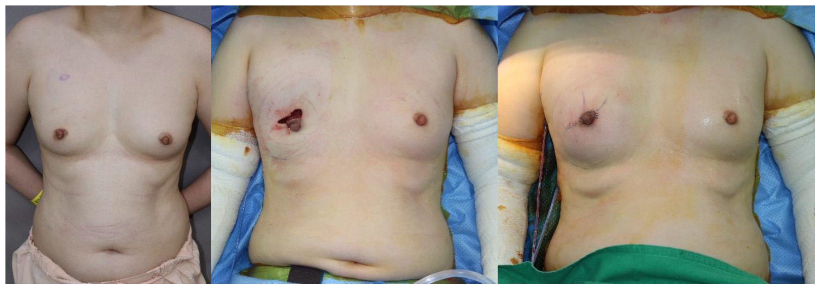 Medicina 56 00537 g002