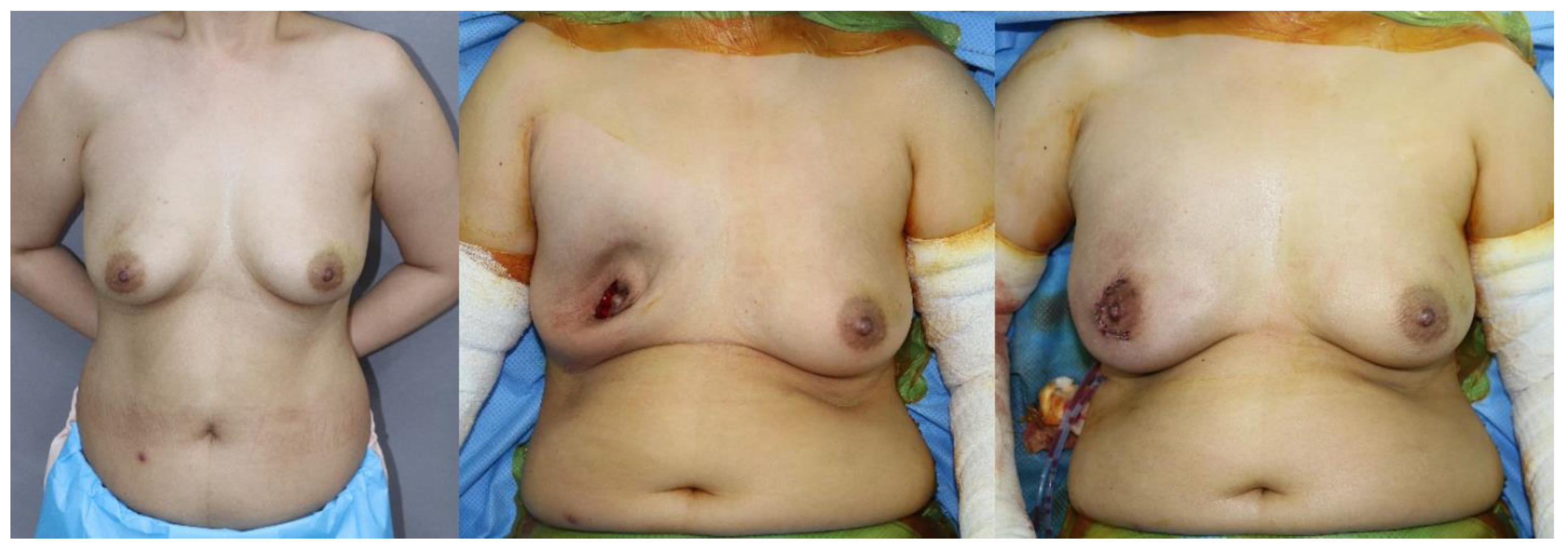 Medicina 56 00537 g003