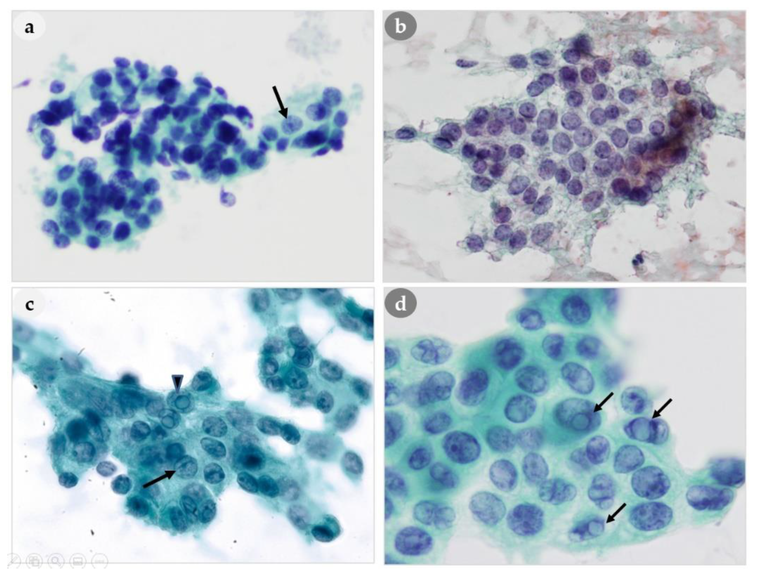 Medicina 56 00558 g004
