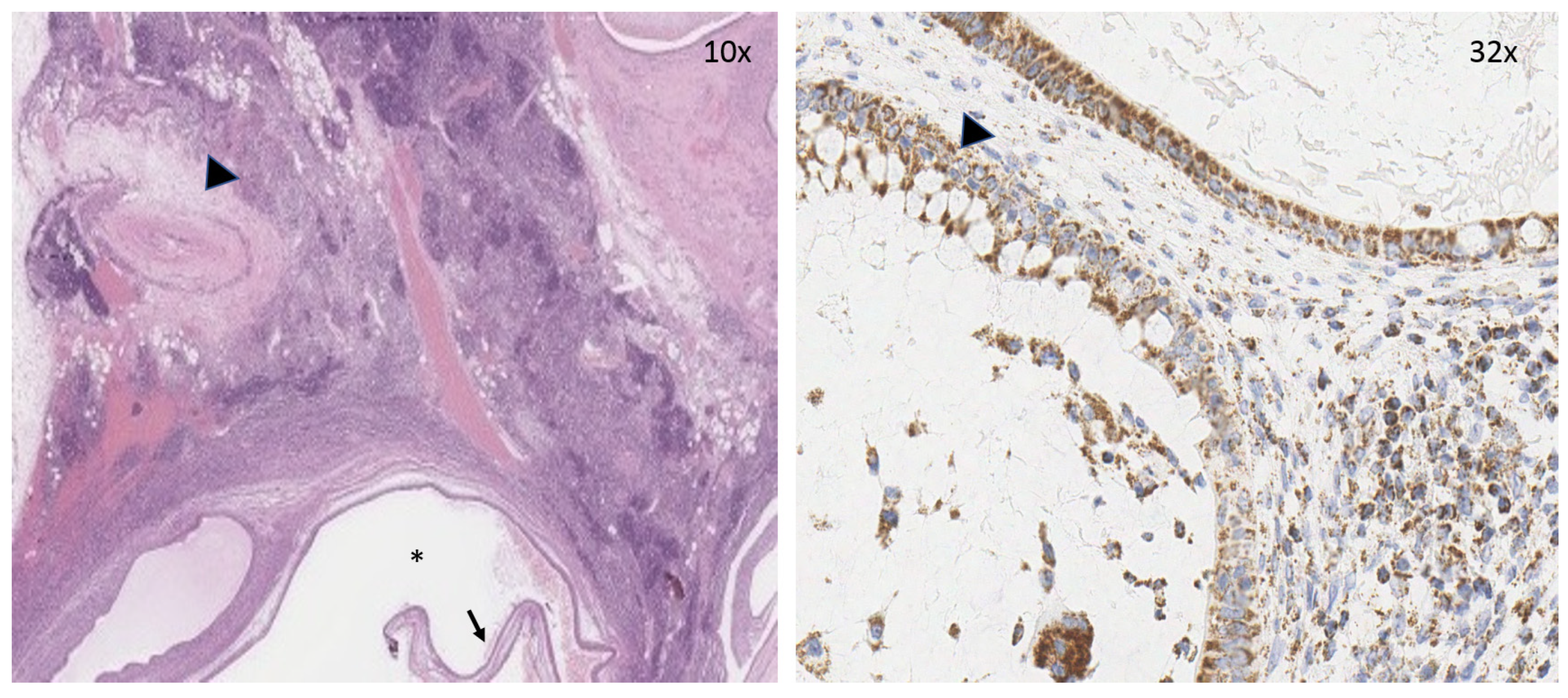 Medicina 56 00561 g003 Medicina 56 00561 g003