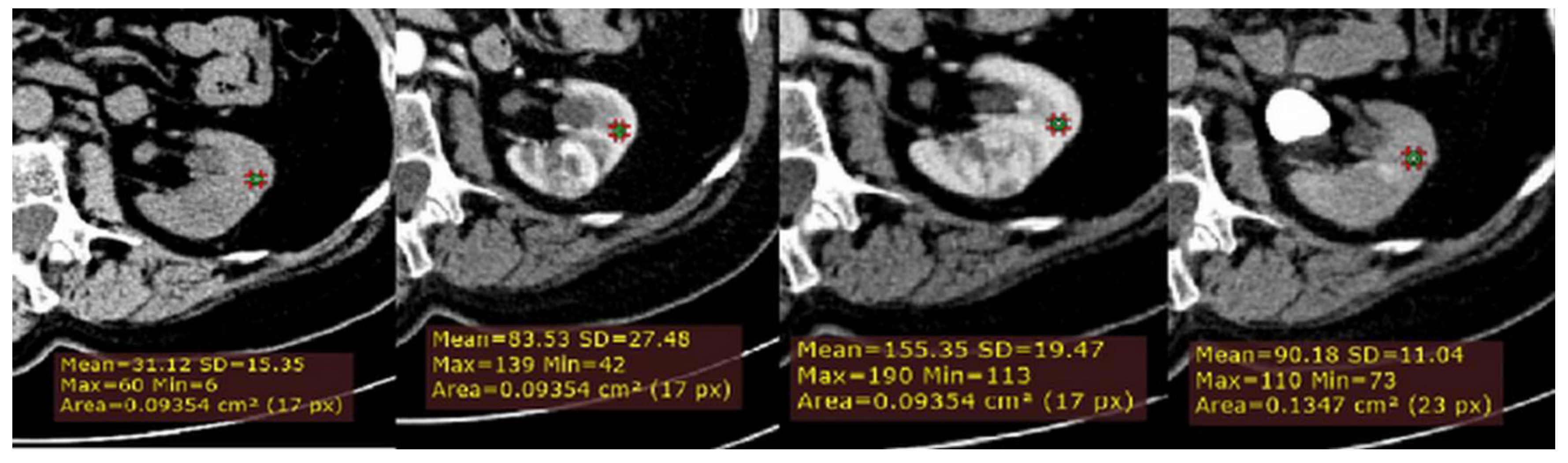 Medicina 56 00569 g002