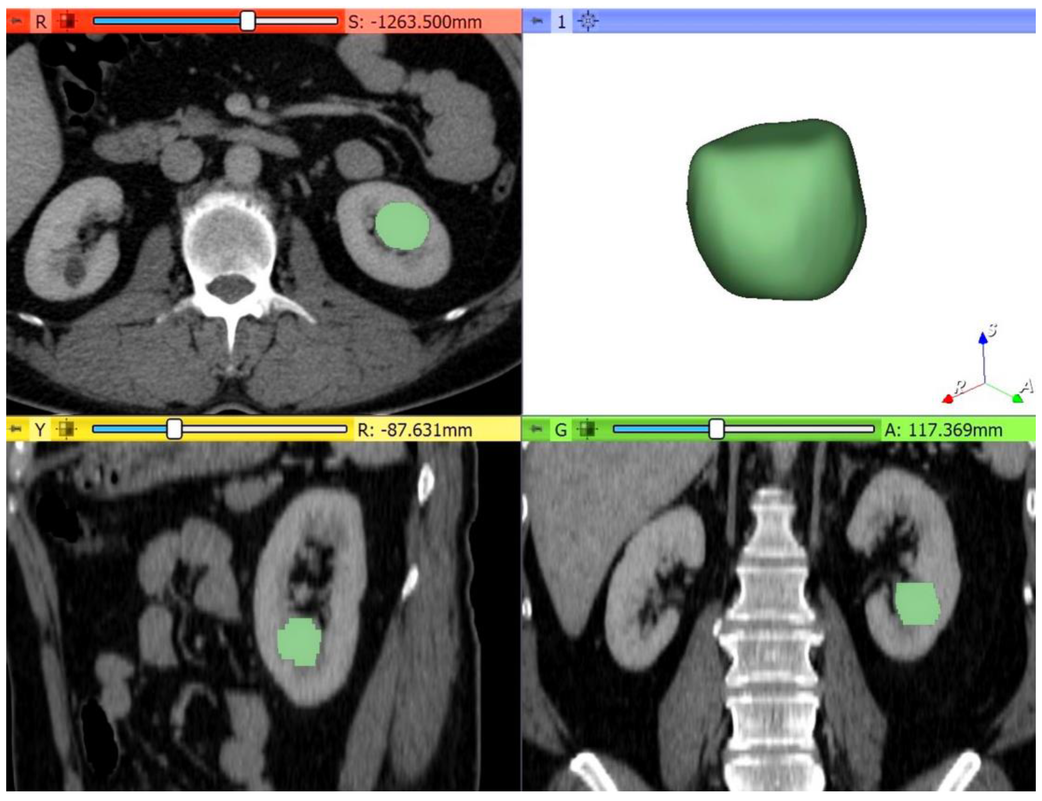 Medicina 56 00569 g003