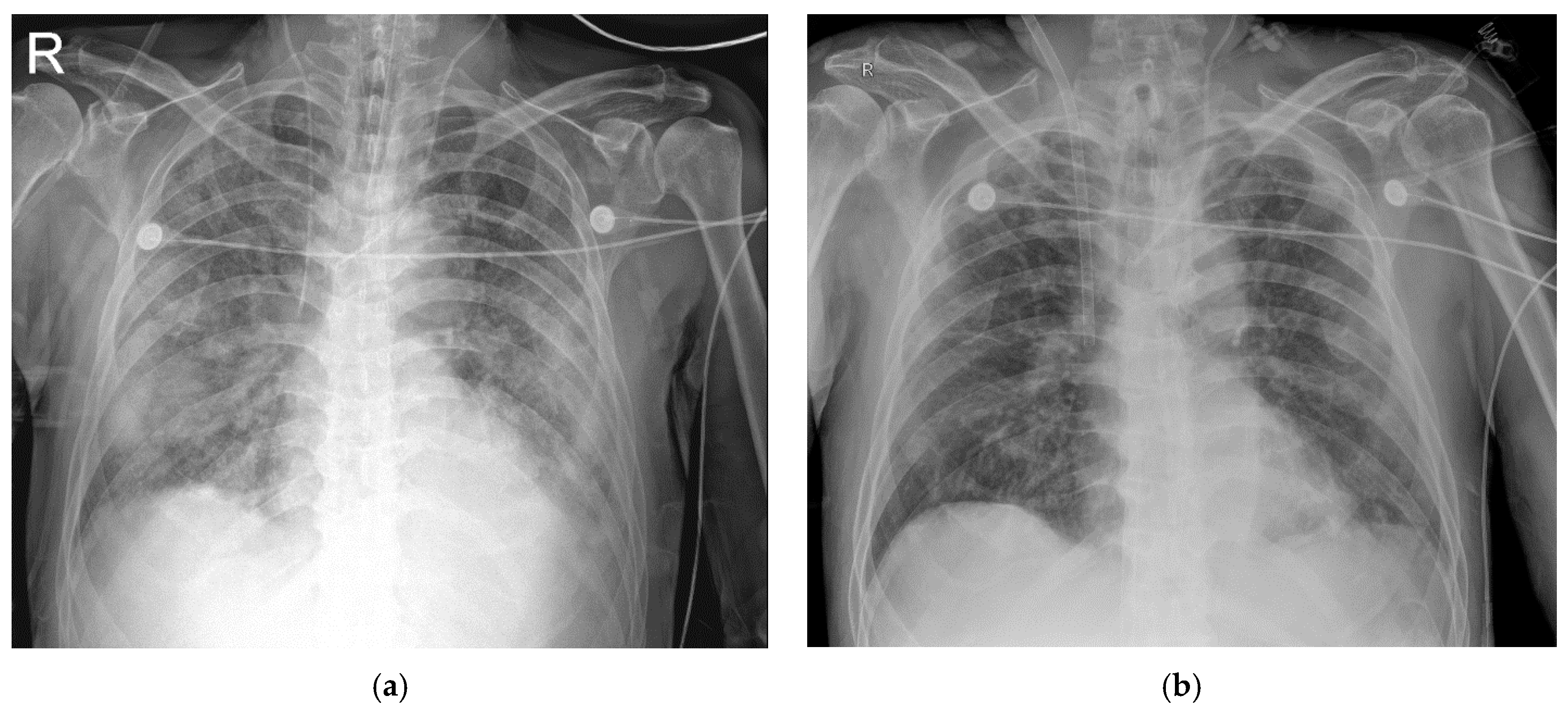 Medicina 56 00570 g002 Medicina 56 00570 g002