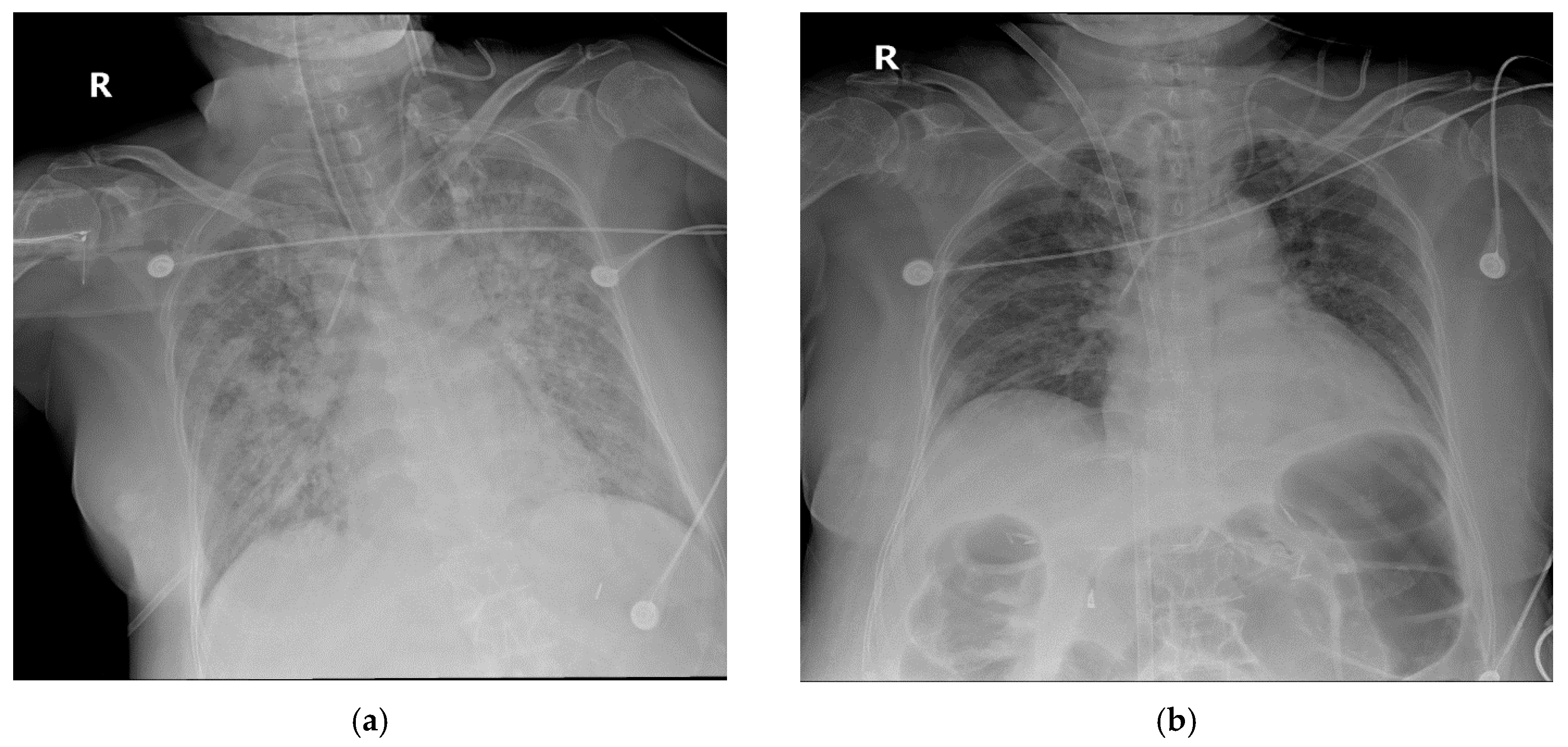 Medicina 56 00570 g004 Medicina 56 00570 g004