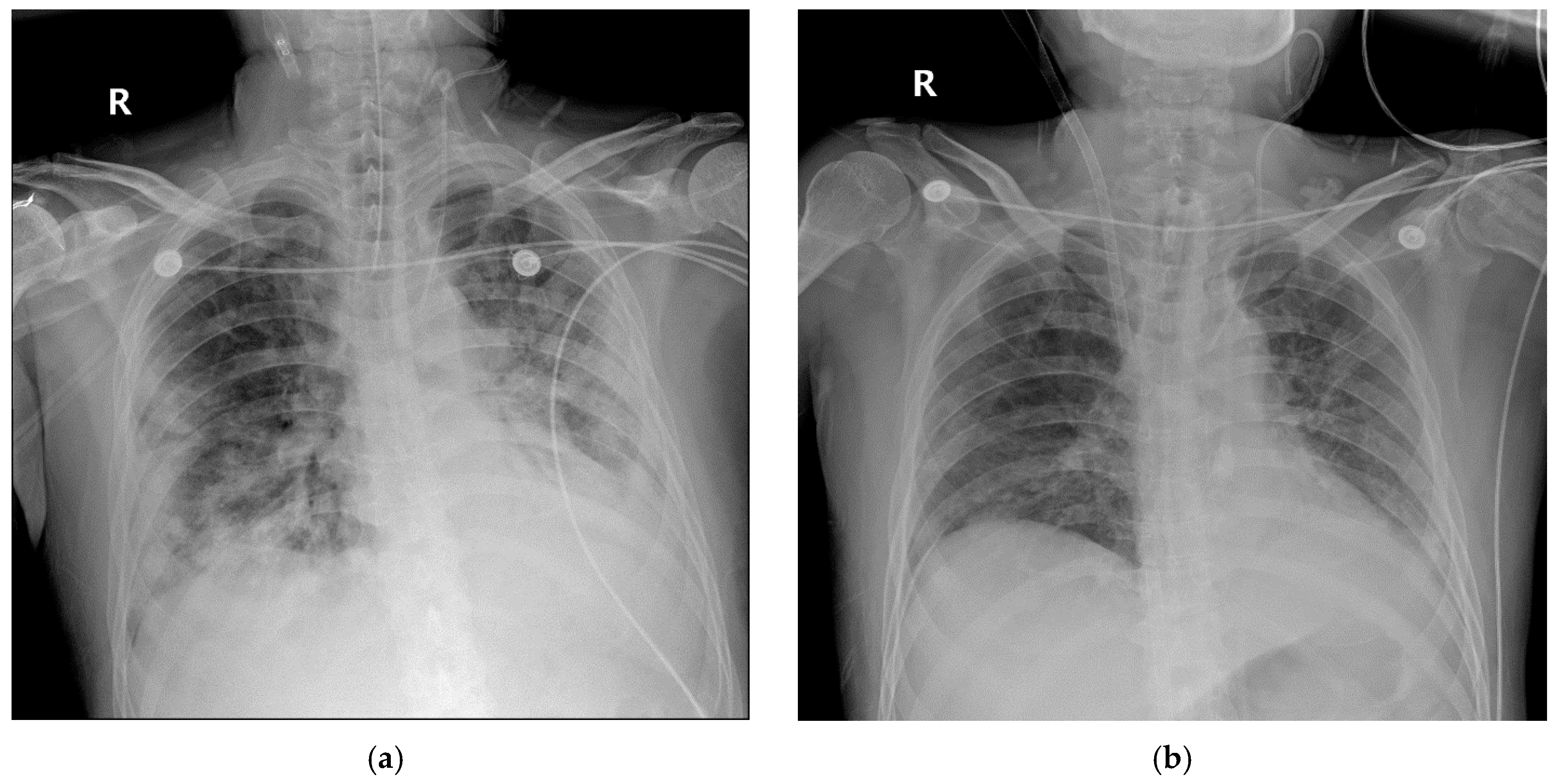 Medicina 56 00570 g006 Medicina 56 00570 g006