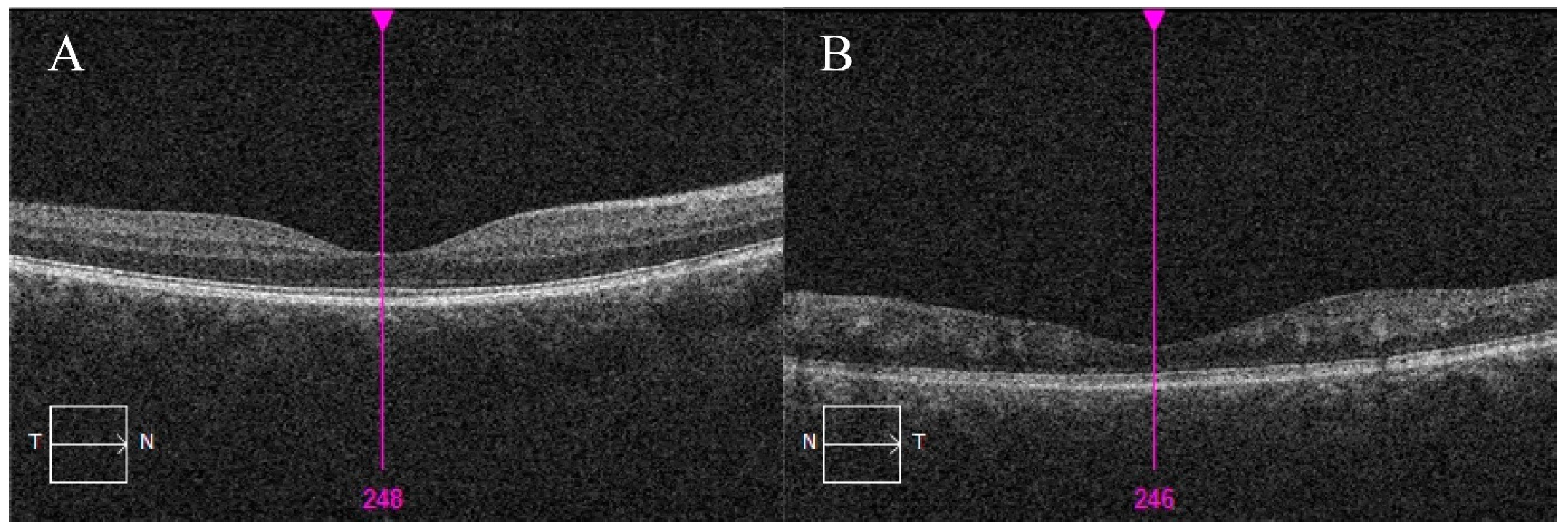 Medicina 56 00598 g003