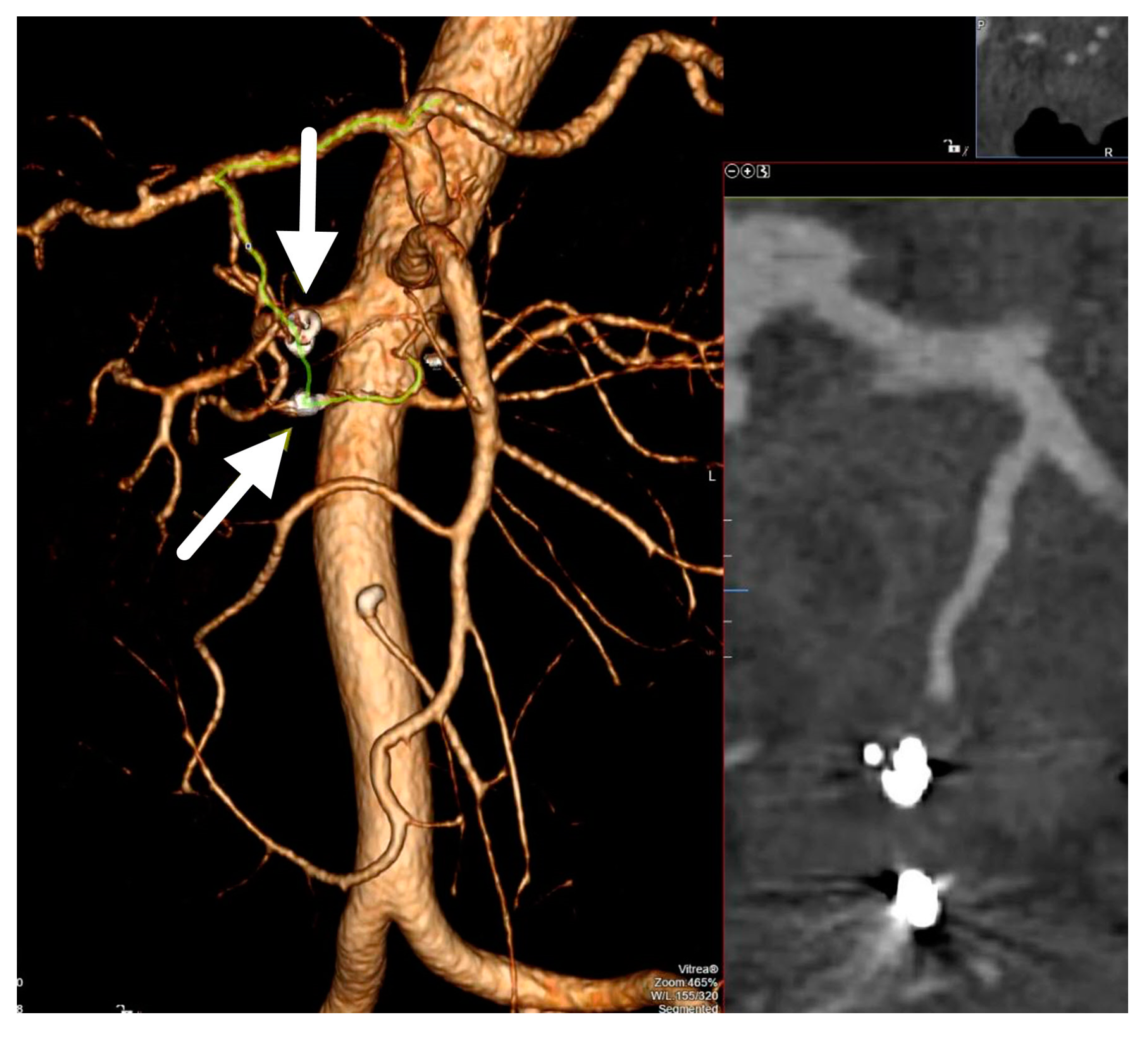 Medicina 56 00617 g005