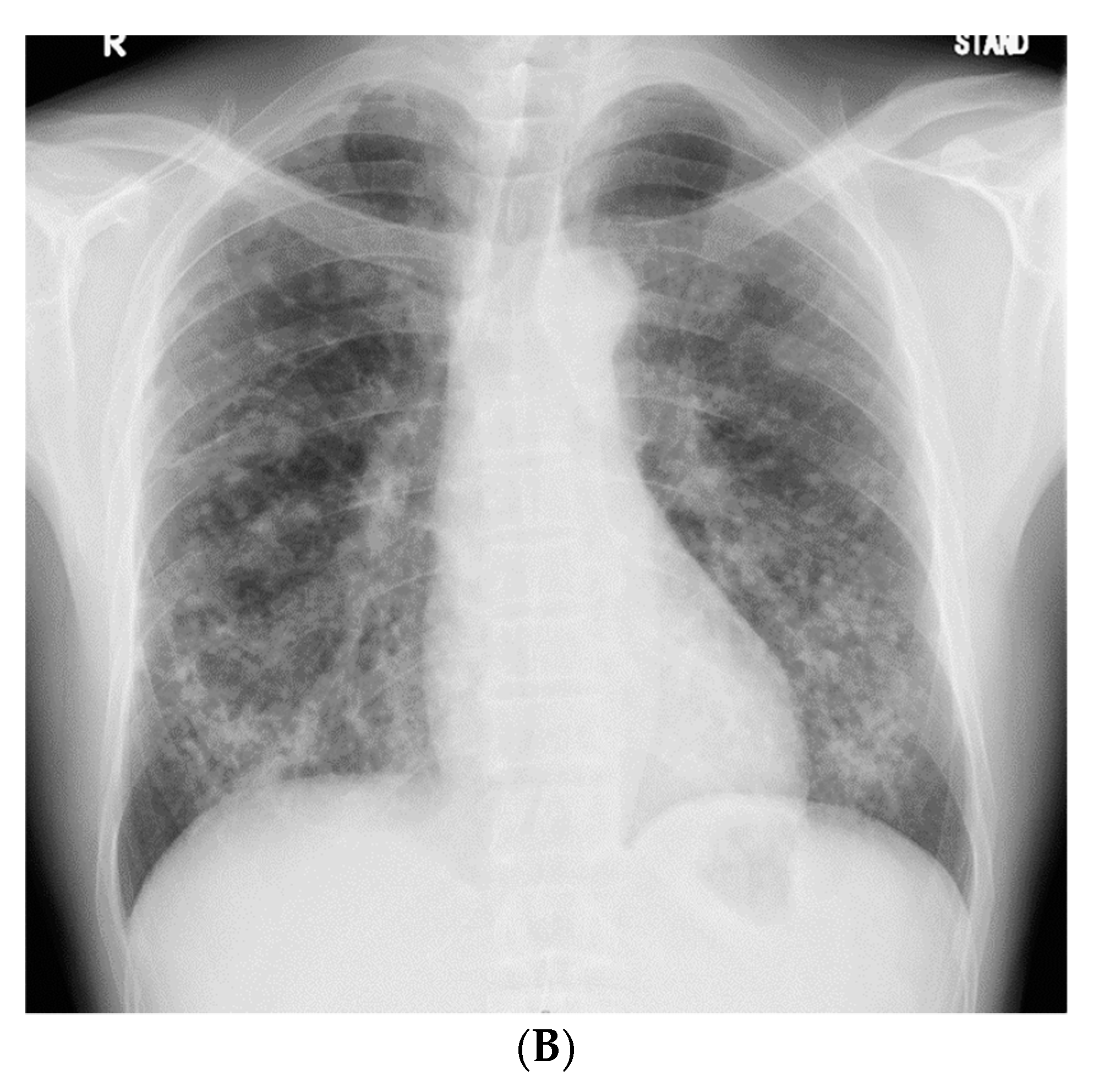 Medicina 56 00630 g001b