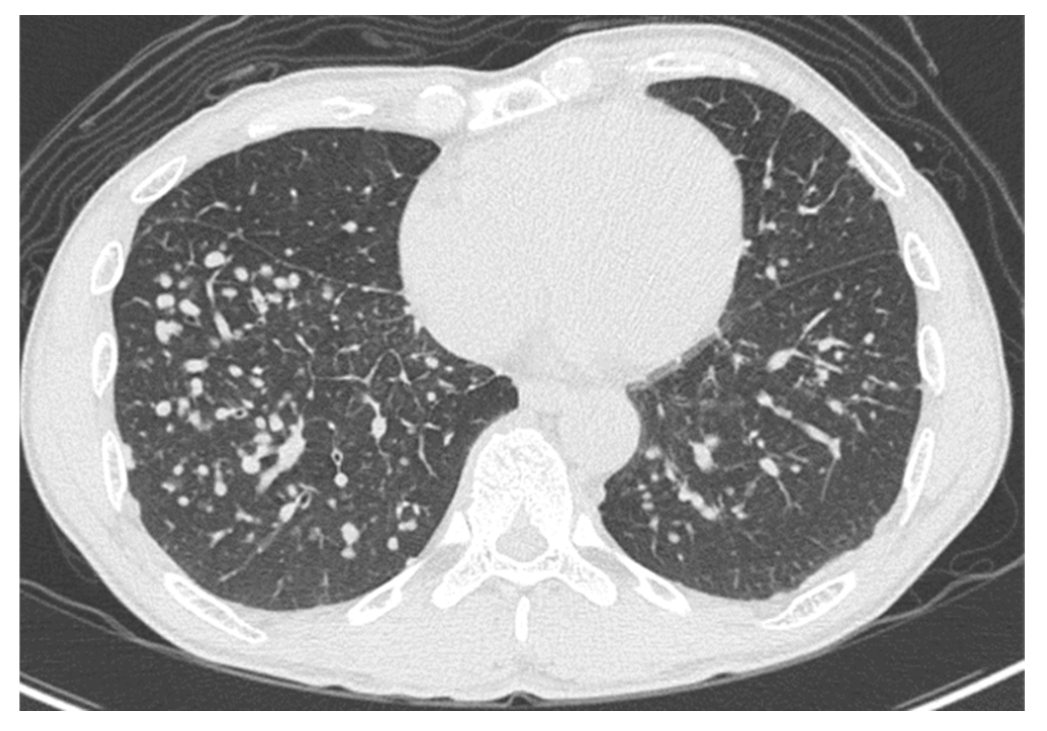 Medicina 56 00630 g002
