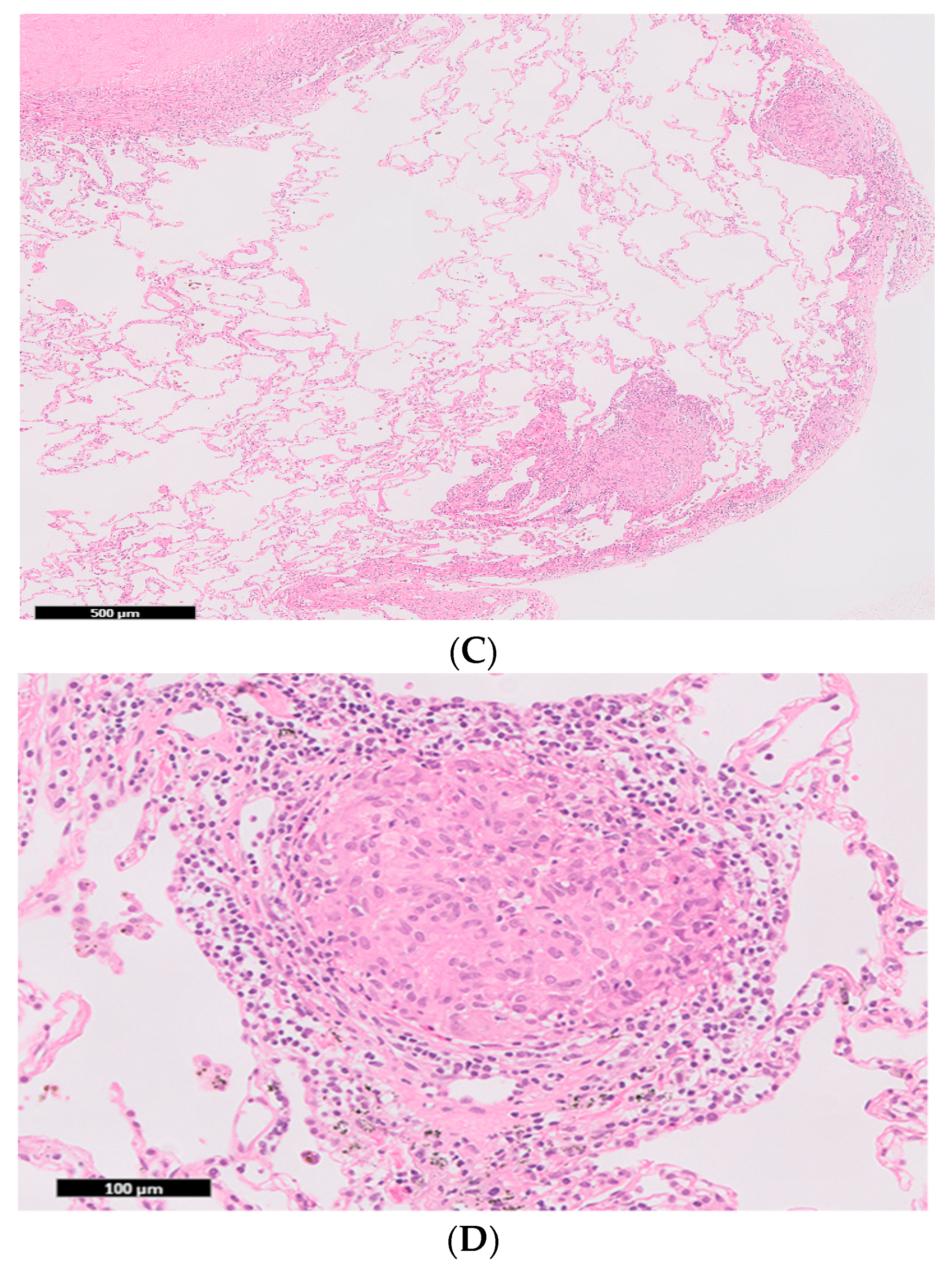 Medicina 56 00630 g003b