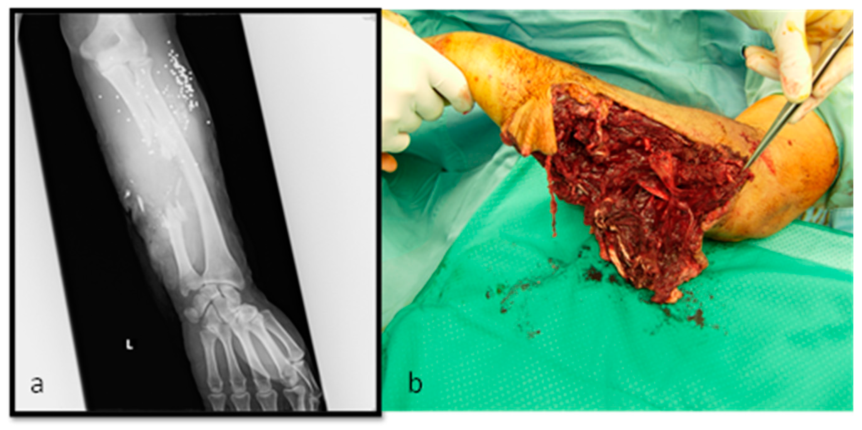 Medicina 56 00632 g003