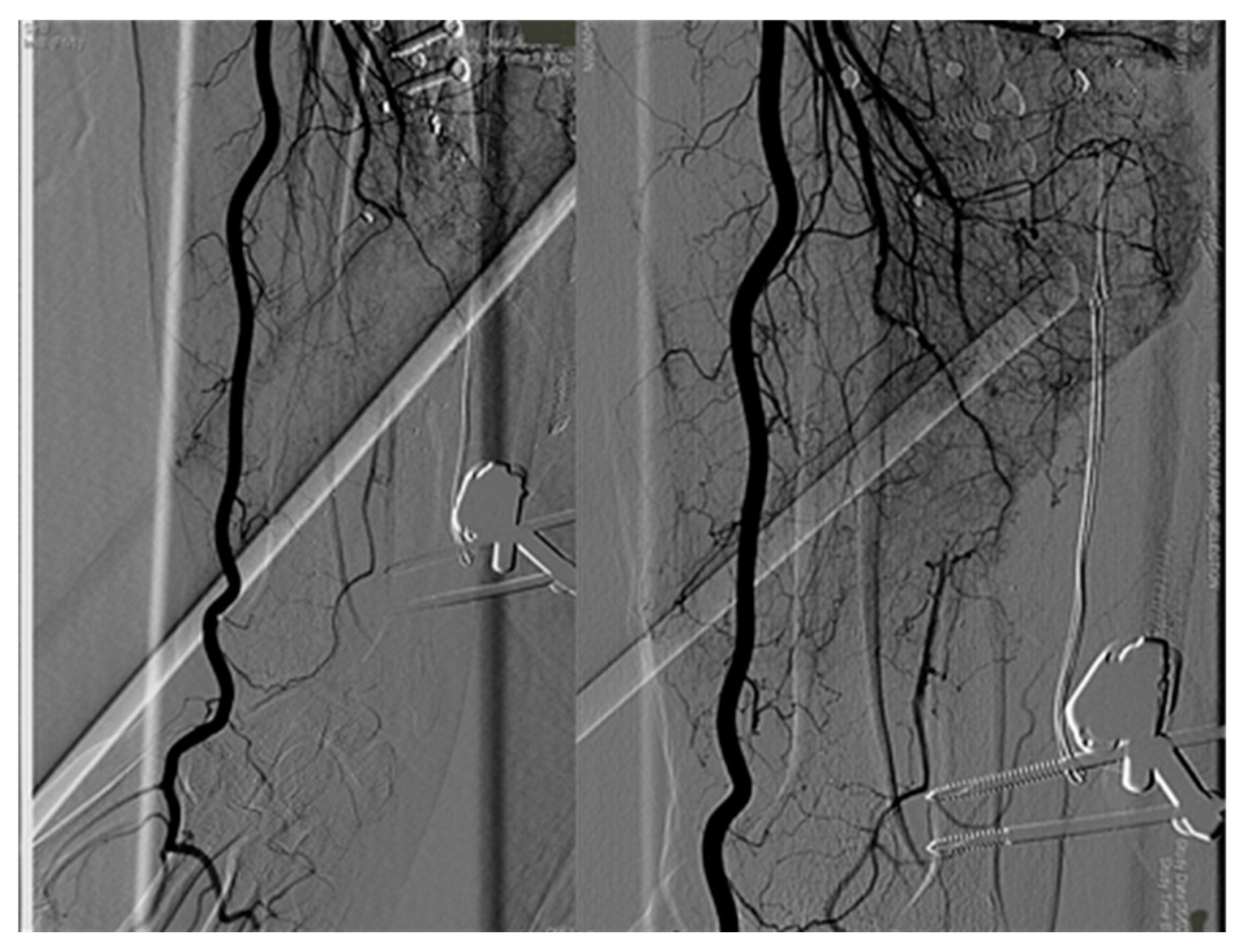 Medicina 56 00632 g004