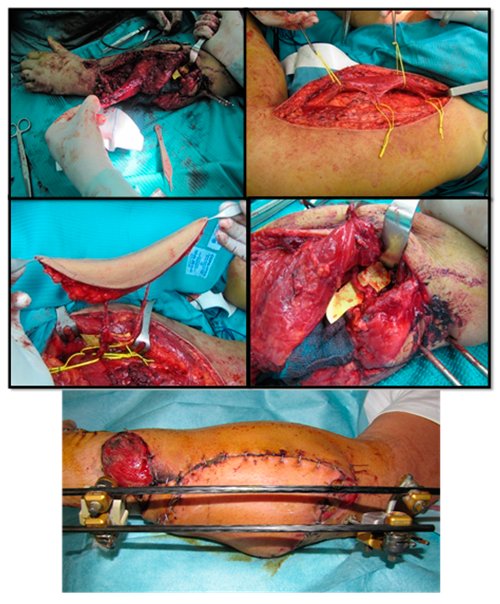 Medicina 56 00632 g005