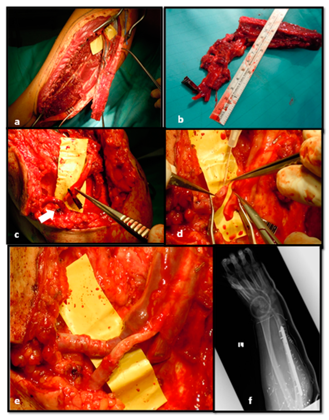 Medicina 56 00632 g007