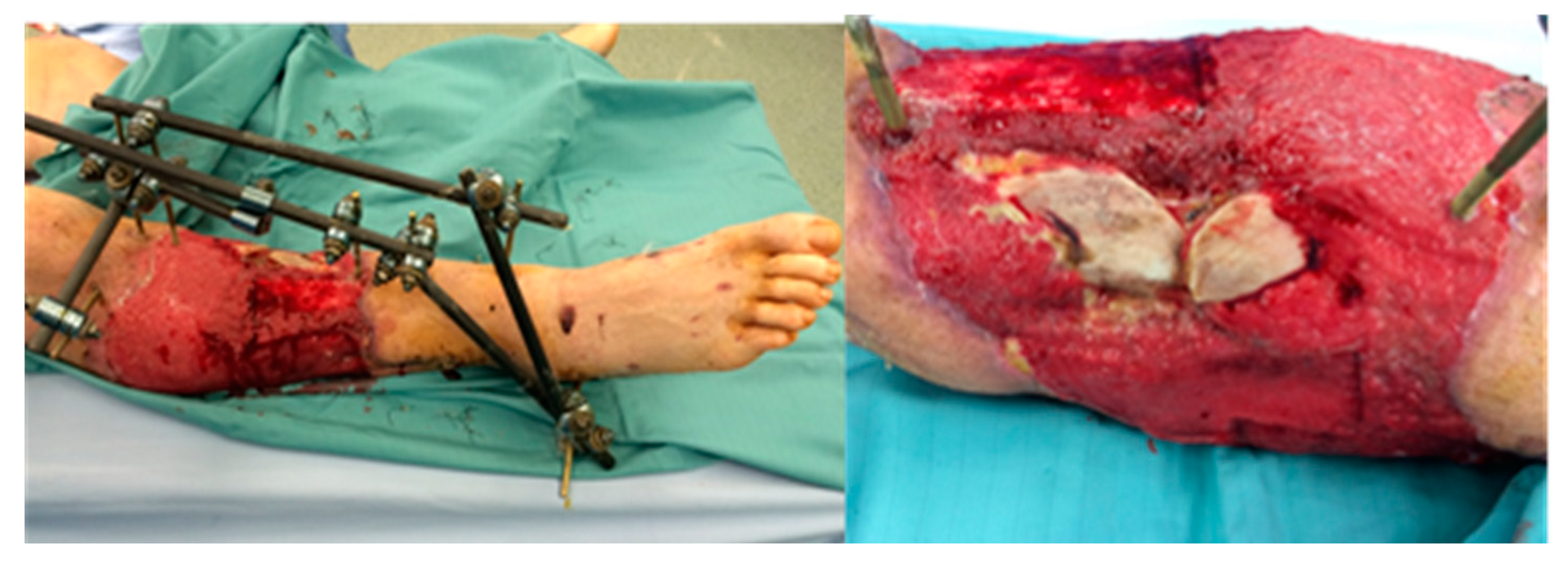 Medicina 56 00632 g009